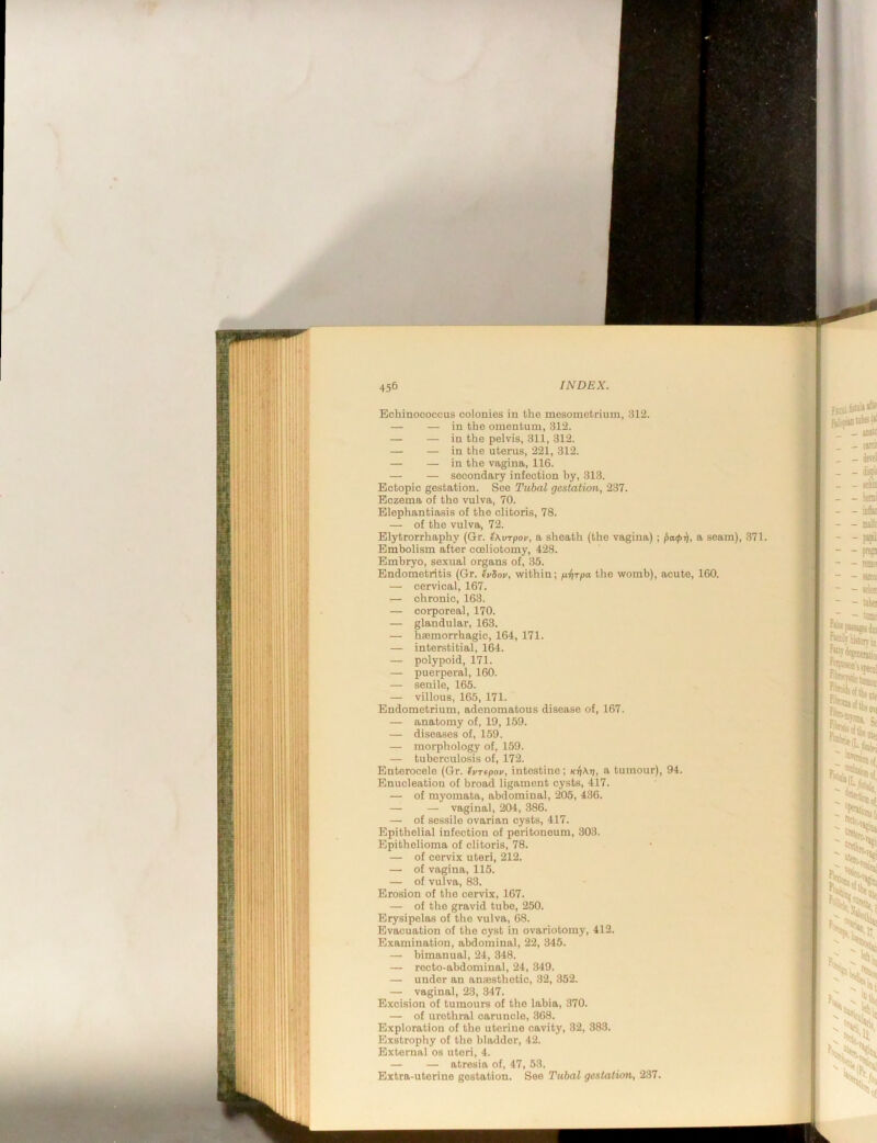 Echinococcus colonies in the mesometrium, 312. — — in the omentum, 312. — — in the pelvis, 311, 312. — — in the uterus, 221, 312. — — in the vagina, 116. — — secondary infection by, 313. Ectopic gestation. See Tubal gestation, 237. Eczema of tho vulva, 70. Elephantiasis of the clitoris, 78. — of the vulva, 72. Elytrorrhaphy (Gr. Ixvrpov, a sheath (the vagina) ; a seam), 371. Embolism after cceliotomy, 428. Embryo, sexual organs of, 35. Endometritis (Gr. ei/Sov, within; /xlirpa the womb), acute, 160. — cervical, 167. — chronic, 163. — corporeal, 170. — glandular, 163. — haemorrhagic, 164, 171. — interstitial, 164. — polypoid, 171. — puerperal, 160. — senile, 165. — villous, 165, 171. Endometrium, adenomatous disease of, 167. — anatomy of, 19, 159. — diseases of, 159. — morphology of, 159. — tuberculosis of, 172. Enterocele (Gr. (urtpov, intestine; Kri\rt, a tumour), 94. Enucleation of broad ligament cysts, 417. —' of myomata, abdominal, 205, 436. — — vaginal, 204, 386. — of sessile ovarian cysts, 417. Epithelial infection of peritoneum, 303. Epithelioma of clitoris, 78. — of cervix uteri, 212. — of vagina, 115. — of vulva, 83. Erosion of the cervix, 167. — of tho gravid tube, 250. Erysipelas of tho vulva, 68. Evacuation of the cyst in ovariotomy, 412. Examination, abdominal, 22, 345. — bimanual, 24, 348. — recto-abdominal, 24, 349. — under an aneesthotic, 32, 352. — vaginal, 23, 347. Excision of tumours of tho labia, 370. — of urethral caruncle, 368. Exploration of tho uterine cavity, 32, 383. Exstrophy of the bladder, 42. External os uteri, 4. — — atresia of, 47, 53. Extra-uterine gestation. See Tubal gestation, 237.