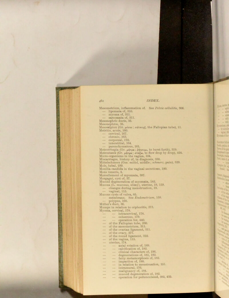 Mesometrium, iuflammation of. See Pelvic cellulitis, 306. — lipomata of, 310. — myoma of, 311. — sarcomata of, 311. Mesonephric ducts, 35. Mesonephros, 35. Mesosalpinx (Gr. /aeVoy; o-aKniy^, the Fallopian tube), 11. Metritis, acute, 100. — cervical, 167. — chronic, 163. — corporeal, 170. — intei-stitial, 104. — parenchymatous, 161. Metrorrhagia (Gr. /iT)Tpa; l>i\yvupu, to burst forth), 319. Metrostaxis (Gr. fii)Tpa; to flow drop by drop), 424. Micro-organisms in the vagina, 104. Miscarriages, history of, in diagnosis, 338. Mittelschmerz (Ger. mittel, middle; schnicrz, pain), 329. Mole, tubal, 239. Monilia Candida in the vaginal secretions, 100. Mons veneris, 5. Morcellement of myomata, 387. Morgagni, cyst of, 37. Mucoid degeneration of myomata, 182. Mucosa (L. mucosus, slimy), uterine, 19, 159. — changes during menstruation, 19. — vaginal, 115. Mucous cysts of vulva, 85. — membrane. See Endometrium, 159. — polypus, 168. Miiller’s duct, 36. Mumps in relation to oophoritis, 273. Myoma, cervical, 178. — — inti’acervical, 178. — — subserous, 179. — — operation for, 440. — of the Fallopian tube, 2.30. — of tlie mesometrium, 311. — of the ovarian ligament, 311. — of the ovary, 277. — of the round ligament, 310. — of the vagina, 115. — uterine, 174. — — axial rotation of, 189. — — calcification of, 182. — — clinical characters of, 190. — — degenerations of, 181, 182. — — fatty metamorphosis of, 182. — — impaction of, 188. — — in relation to menstruation, 191. — — intramural, 176. — — malignancy of, 184. — — mucoid degeneration of, 182. — — operation for pedunculated, 385, 435.