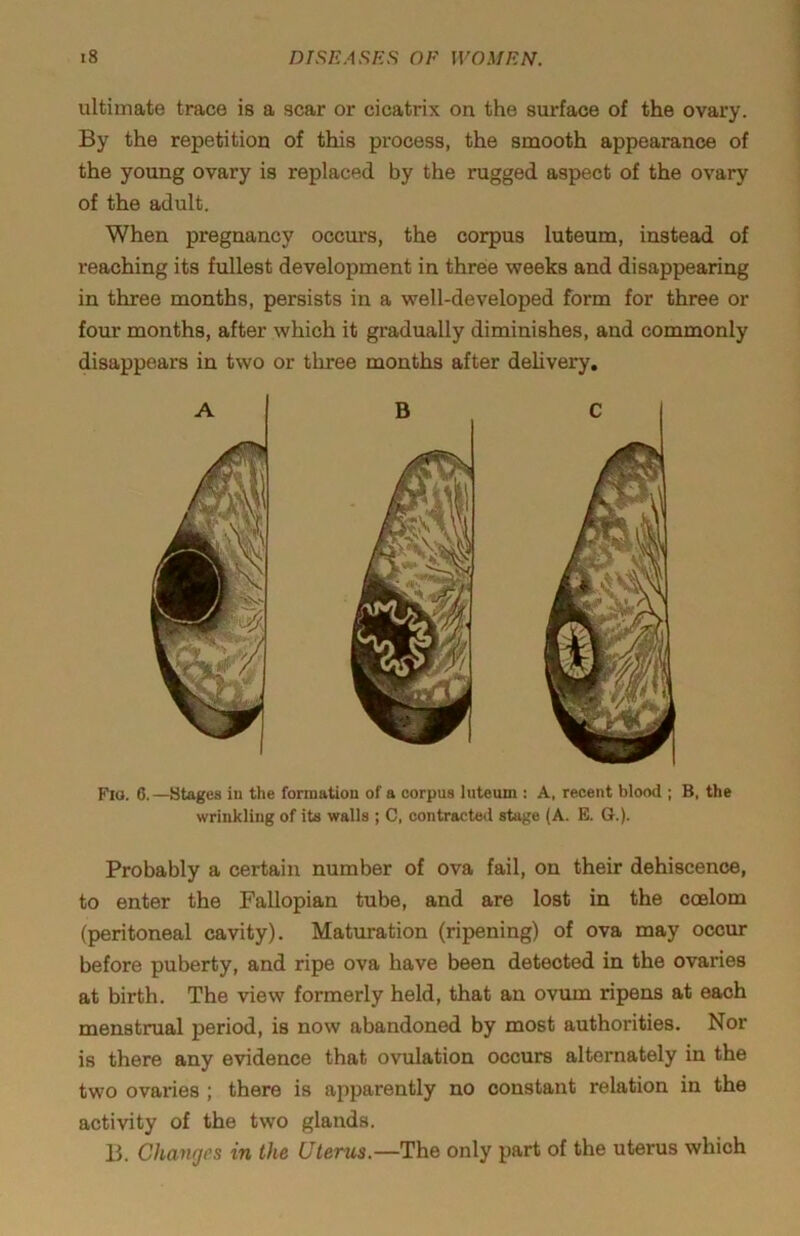 ultimate trace is a scar or cicatrix on the surface of the ovary. By the repetition of this process, the smooth appearance of the young ovary is replaced by the rugged aspect of the ovary of the adult. When pregnancy occurs, the corpus luteum, instead of reaching its fullest development in threie weeks and disappearing in three months, persists in a well-developed form for three or four months, after which it gradually diminishes, and commonly disappears in two or three months after delivery. Flo. 6.—Stages in the formation of a corpus luteum : A, recent blood ; B, the wrinkling of its walls ; C, contracted stage (A. E. G.). Probably a certain number of ova fail, on their dehiscence, to enter the Fallopian tube, and are lost in the coelom (peritoneal cavity). Maturation (ripening) of ova may occur before puberty, and ripe ova have been detected in the ovaries at birth. The view formerly held, that an ovum ripens at each menstrual period, is now abandoned by most authorities. Nor is there any evidence that ovulation occurs alternately in the two ovaries ; there is apparently no constant relation in the activity of the two glands. B. Changes in the Uterus.—The only part of the uterus which