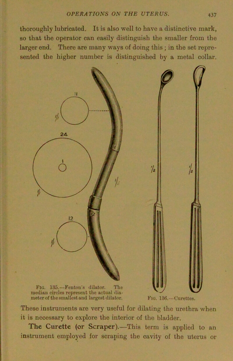 thoroughly lubricated. It is also well to have a distinctive mark, so that the operator can easily distinguish the smaller from the larger end. There are many ways of doing this ; in the set repre- sented the higher number is distinguished by a metal collar. Fig. 135.—Fenton's dilator. The median circles represent the actual dia- meter of the smallest and largest dilator. These instruments are very useful for dilating the urethra when it is necessary to explore the interior of the bladder. The Curette (or Scraper).—This term is applied to an instrument employed for scraping the cavity of the uterus or