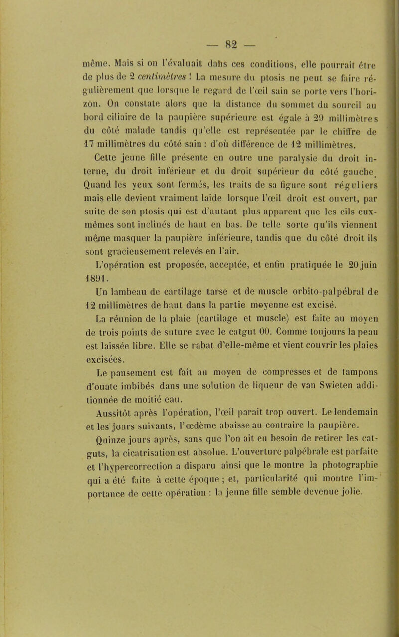 môme. Mais si on l’évaluait dahs ces conditions, elle pourrait être de plus de 2 centimètres ! La mesure du ptosis ne peut se faire ré- gulièrement que lorsque le regard de l’œil sain se porte vers l’hori- zon. On constate alors que la distance du sommet du sourcil au bord ciliaire de la paupière supérieure est égale à 2!) millimètres du côté malade tandis qu’elle est représentée par le chiffre de 17 millimètres du côté sain : d’où différence de 12 millimètres. Cette jeune fille présente en outre une paralysie du droit in- terne, du droit inférieur et du droit supérieur du côté gauche Quand les yeux sont fermés, les traits de sa figure sont réguliers mais elle devient vraiment laide lorsque l’œil droit est ouvert, par suite de son ptosis qui est d’autant plus apparent que les cils eux- mêmes sont inclinés de haut en bas. De telle sorte qu’ils viennent même masquer la paupière inférieure, tandis que du côté droit ils sont gracieusement relevés en l’air. L’opération est proposée, acceptée, et enfin pratiquée le 20 juin 1891. Un lambeau de cartilage tarse et de muscle orbito-palpébral de 12 millimètres de haut dans la partie moyenne est excisé. La réunion de la plaie (cartilage et muscle) est faite au moyen de trois points de suture avec le catgut 00. Comme toujours la peau est laissée libre. Elle se rabat d’elle-même et vient couvrir les plaies excisées. Le pansement est fait au moyen de compresses et de tampons d’ouate imbibés dans une solution de liqueur de van Swielen addi- tionnée de moitié eau. Aussitôt après l’opération, l’œil parait trop ouvert. Le lendemain et les jours suivants, l’œdème abaisse au contraire la paupière. Quinze jours après, sans que l’on ait eu besoin de retirer les cat- guts, la cicatrisation est absolue. L’ouverture palpébrale est parfaite et l’hypercorrection a disparu ainsi que le montre la photographie qui a été faite à celte époque ; et, particularité qui montre l'im- portance de cette opération : la jeune fille semble devenue jolie.
