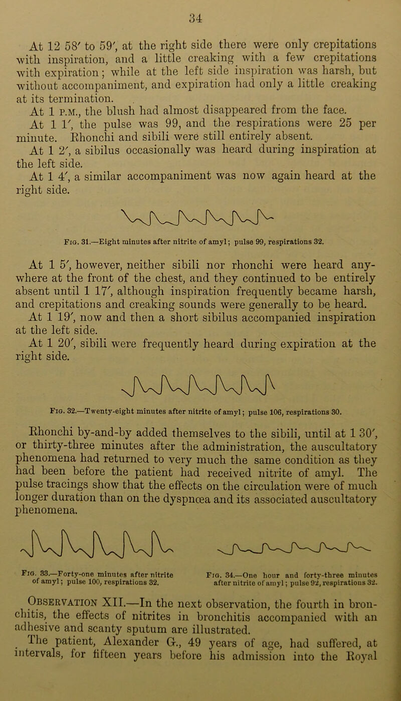 At 12 58' to 59', at the right side there were only crepitations with inspiration, and a little creaking with a few crepitations with expiration; while at the left side inspiration was harsh, but without accompaniment, and expiration had only a little creaking at its termination. At 1 P.M., the blush had almost disappeared from the face. At 1 1', the pulse was 99, and the respirations were 25 per minute. Ehonchi and sibili were still entirely absent. At 1 2', a sibilus occasionally was heard during inspiration at the left side. At 1 4', a similar accompaniment was now again heard at the right side. Fig. 31.—Eight minutes after nitrite of amyl; pulse 99, respirations 32. At 1 5', however, neither sibili nor rhonchi were heard any- where at the front of the chest, and they continued to be entirely absent until 1 17', although inspiration frequently became harsh, and crepitations and creaking sounds were generally to be heard. At 1 19', now and then a short sibilus accompanied inspiration at the left side. At 1 20', sibili were frequently heard during expiration at the right side. Fig. 32.—Twenty-eight minutes after nitrite of amyl; pulse 106, respirations 30. Ehonchi by-and-by added themselves to the sibili, until at 1 30', or thirty-three minutes after the administration, the auscultatory phenomena had returned to very much the same condition as they had been before the patient had received nitrite of amyl. The pulse tracings show that the effects on the circulation were of much longer duration than on the dyspnoea and its associated auscultatory phenomena. Fig. 33.—Forty-one minutes after nitrite Fig. 34.—One hour and forty-three minutes of amyl; pulse 100, respirations 32. after nitrite of amyl; pulse 92, respirations 32. Observation XII.—In the next observation, the fourth in broii- cliitis, the effects of nitrites in bronchitis accompanied with an adhesive and scanty sputum are illustrated. The patient, Alexander G., 49 years of age, had suffered, at intervals, for fifteen years before his admi.ssion into tlie Eoyal