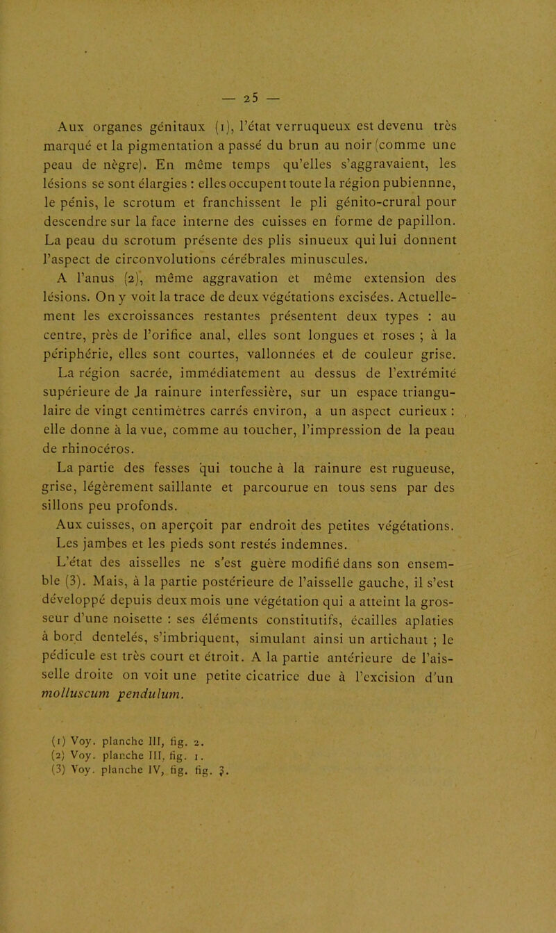 Aux organes génitaux (i), l’état verruqueux est devenu très marqué et la pigmentation a passé du brun au noir (comme une peau de nègre). En même temps qu’elles s’aggravaient, les lésions se sont élargies : elles occupent toute la région pubiennne, le pénis, le scrotum et franchissent le pli génito-crural pour descendre sur la face interne des cuisses en forme de papillon. La peau du scrotum présente des plis sinueux qui lui donnent l’aspect de circonvolutions cérébrales minuscules. A l’anus (2), même aggravation et même extension des lésions. On y voit la trace de deux végétations excisées. Actuelle- ment les excroissances restantes présentent deux types : au centre, près de l’orifice anal, elles sont longues et roses ; à la périphérie, elles sont courtes, vallonnées et de couleur grise. La région sacrée, immédiatement au dessus de l'extrémité supérieure de Ja rainure interfessière, sur un espace triangu- laire de vingt centimètres carrés environ, a un aspect curieux : elle donne à la vue, comme au toucher, l’impression de la peau de rhinocéros. La partie des fesses qui touche à la rainure est rugueuse, grise, légèrement saillante et parcourue en tous sens par des sillons peu profonds. Aux cuisses, on aperçoit par endroit des petites végétations. Les jambes et les pieds sont restés indemnes. L’état des aisselles ne s’est guère modifié dans son ensem- ble (3). Mais, à la partie postérieure de l’aisselle gauche, il s’est développé depuis deux mois une végétation qui a atteint la gros- seur d’une noisette : ses éléments constitutifs, écailles aplaties à bord dentelés, s’imbriquent, simulant ainsi un artichaut ; le pédicule est très court et étroit. A la partie antérieure de l’ais- selle droite on voit une petite cicatrice due à l’excision d’un molluscum pendulum. (1) Voy. planche 111, fig. a. (2) Voy. planche III, fïg. 1. (3) Voy. planche IV, tig. fig. J.