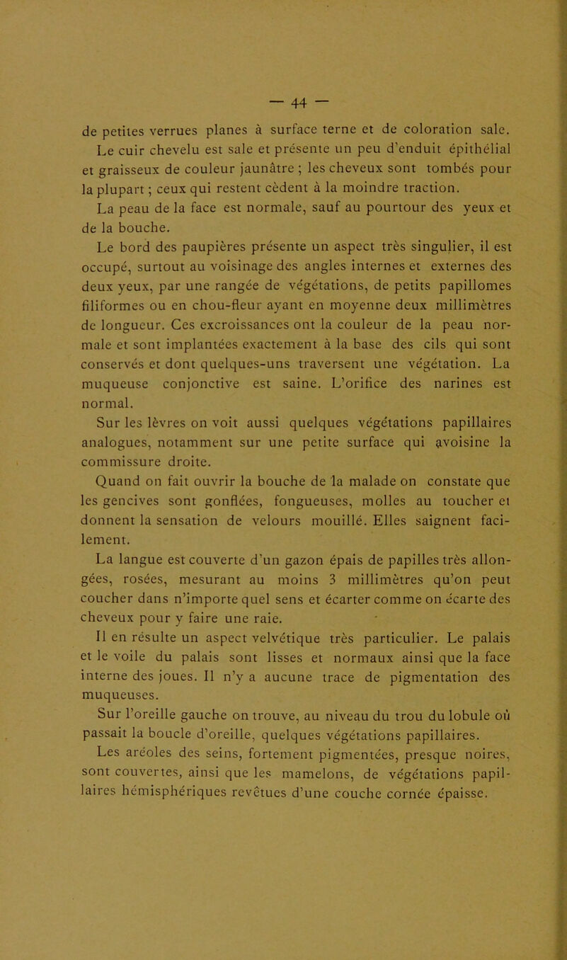 de petites verrues planes à surface terne et de coloration sale. Le cuir chevelu est sale et présente un peu d'enduit épithélial et graisseux de couleur jaunâtre ; les cheveux sont tombés pour la plupart ; ceux qui restent cèdent à la moindre traction. La peau de la face est normale, sauf au pourtour des yeux et de la bouche. Le bord des paupières présente un aspect très singulier, il est occupé, surtout au voisinage des angles internes et externes des deux yeux, par une rangée de végétations, de petits papillomes filiformes ou en chou-fleur ayant en moyenne deux millimètres de longueur. Ces excroissances ont la couleur de la peau nor- male et sont implantées exactement à la base des cils qui sont conservés et dont quelques-uns traversent une végétation. La muqueuse conjonctive est saine. L’orifice des narines est normal. Sur les lèvres on voit aussi quelques végétations papillaires analogues, notamment sur une petite surface qui avoisine la commissure droite. Quand on fait ouvrir la bouche de la malade on constate que les gencives sont gonflées, fongueuses, molles au toucher ei donnent la sensation de velours mouillé. Elles saignent faci- lement. La langue est couverte d’un gazon épais de papilles très allon- gées, rosées, mesurant au moins 3 millimètres qu’on peut coucher dans n’importe quel sens et écarter comme on écarte des cheveux pour y faire une raie. 11 en résulte un aspect velvétique très particulier. Le palais et le voile du palais sont lisses et normaux ainsi que la face interne des joues. Il n’y a aucune trace de pigmentation des muqueuses. Sur l’oreille gauche on trouve, au niveau du trou du lobule où passait la boucle d’oreille, quelques végétations papillaires. Les aréoles des seins, fortement pigmentées, presque noires, sont couvertes, ainsi que les mamelons, de végétations papil- laires hémisphériques revêtues d’une couche cornée épaisse.