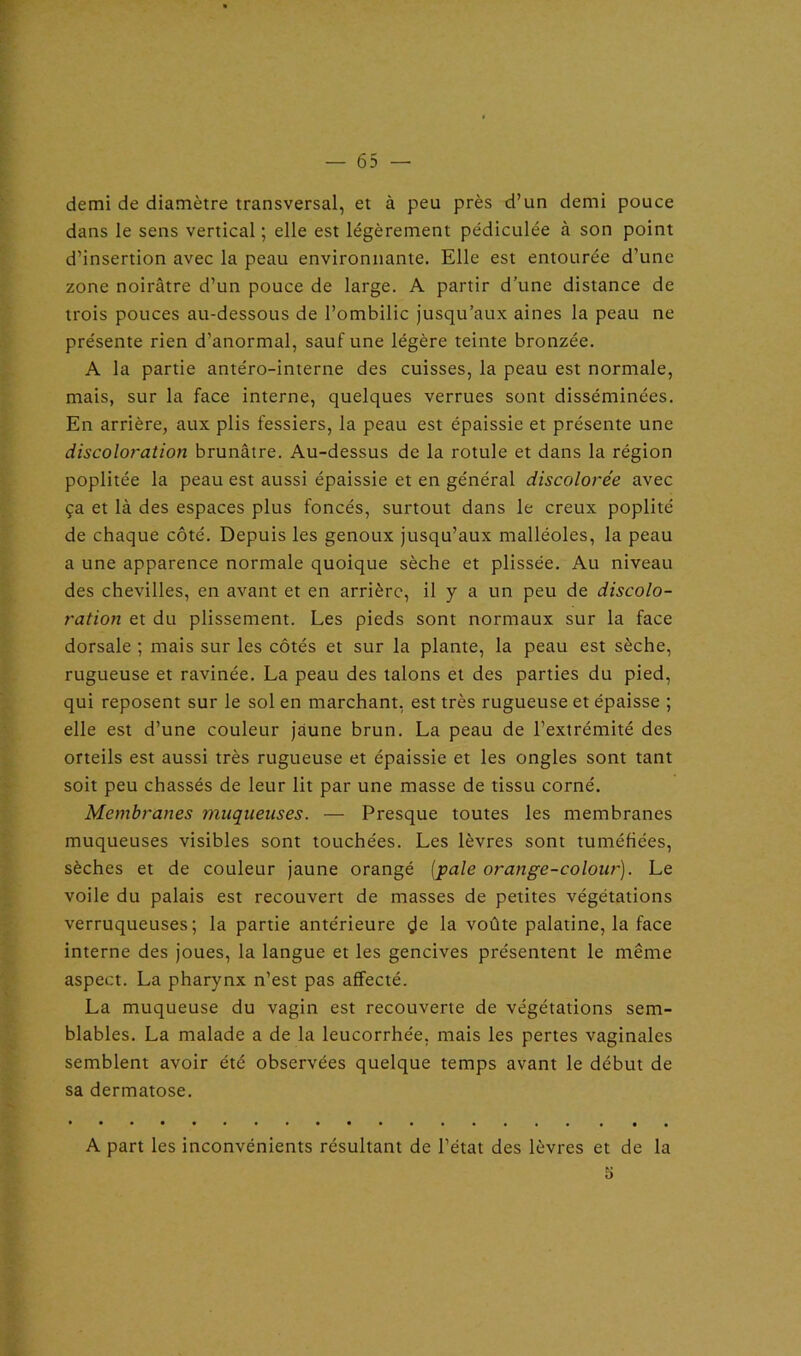 demi de diamètre transversal, et à peu près d’un demi pouce dans le sens vertical ; elle est légèrement pédiculée à son point d’insertion avec la peau environnante. Elle est entourée d’une zone noirâtre d’un pouce de large. A partir d’une distance de trois pouces au-dessous de l’ombilic jusqu’aux aines la peau ne présente rien d’anormal, sauf une légère teinte bronzée. A la partie antéro-interne des cuisses, la peau est normale, mais, sur la face interne, quelques verrues sont disséminées. En arrière, aux plis fessiers, la peau est épaissie et présente une discoloration brunâtre. Au-dessus de la rotule et dans la région poplitée la peau est aussi épaissie et en général discolorée avec ça et là des espaces plus foncés, surtout dans le creux poplité de chaque côté. Depuis les genoux jusqu’aux malléoles, la peau a une apparence normale quoique sèche et plissée. Au niveau des chevilles, en avant et en arrière, il y a un peu de discolo- ration et du plissement. Les pieds sont normaux sur la face dorsale ; mais sur les côtés et sur la plante, la peau est sèche, rugueuse et ravinée. La peau des talons et des parties du pied, qui reposent sur le sol en marchant, est très rugueuse et épaisse ; elle est d’une couleur jaune brun. La peau de l’extrémité des orteils est aussi très rugueuse et épaissie et les ongles sont tant soit peu chassés de leur lit par une masse de tissu corné. Membranes muqueuses. — Presque toutes les membranes muqueuses visibles sont touchées. Les lèvres sont tuméfiées, sèches et de couleur jaune orangé [pale orange-colour). Le voile du palais est recouvert de masses de petites végétations verruqueuses; la partie antérieure de la voûte palatine, la face interne des joues, la langue et les gencives présentent le même aspect. La pharynx n’est pas affecté. La muqueuse du vagin est recouverte de végétations sem- blables. La malade a de la leucorrhée, mais les pertes vaginales semblent avoir été observées quelque temps avant le début de sa dermatose. A part les inconvénients résultant de l’état des lèvres et de la O