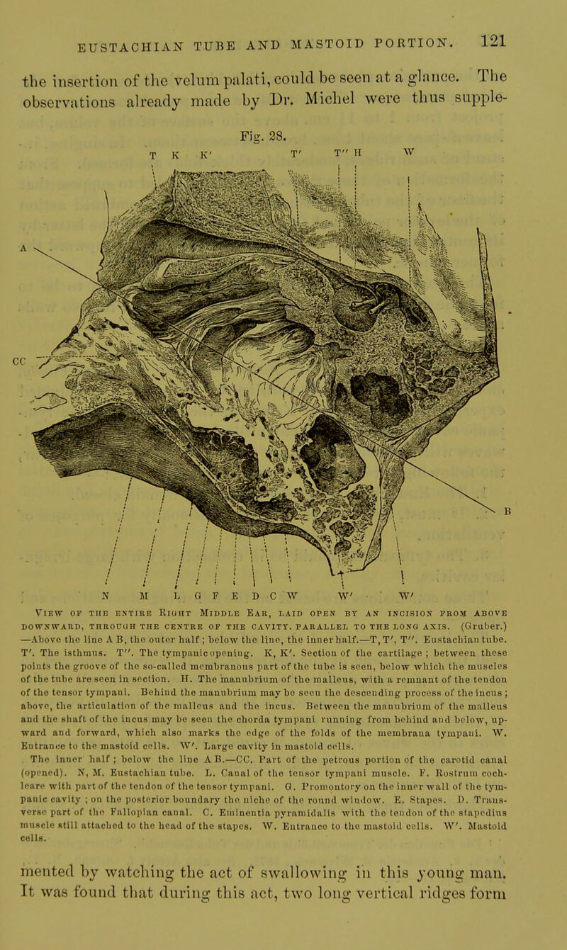 the insertion of the velum palati, could be seen at a glance. The observations already made by Dr. Michel were thus supple- Fig. 38. T 1^ K' T' T II W V'lEW OF THE ENTIRE RiOHT MIDDLE EAK, LAID OPEN BY AN INCISION FROM ABOVE DOWNWARD, THROUUII THE CENTRE OF THE CAVITY. PARALLEL TO THE LONG AXIS. (Gl'uber.) —Above the lino A B, the outer half ; below the line, the inner half.—T, T', T. Eustachian tube. T'. The isthmus. T. The tympanic opening. K, K'. Section of the cartilage; between these points the groove of the so-called membranous part of the tube is seen, below which the muscles of the tube are seen in section. H. The manubrium of the malleus, with a remnant of the tendon of the tensor tympani. Behind the manubrium may be seen the descending process of the incus ; above, the articulation of the malleus and the incus. Between the manubrium of the malleus and the shaft of the incus may be seen the chorda tympani running from beliind and below, up- ward and forward, which also marks the edge of the folds of the membraua tympani. W. Entrance to the mastoid colls. W. Large cavity in mastoid cells. The Inner half ; below the line A B.—CC. Part of the petrous portion of the carotid canal (opened). N, M. Eustachian tube. L. Canal of the tensor tympani muscle. V. Rostrum coch- leare with part of the tendon of the tensor tympani. G. Promontory on the inner wall of the tym- panic cavity ; on the posterior boundary the niche of the round window. E. Stapes. D. Trans- verse part of the Fallopian canal. C. Eniinentia pyraniidalls with the tendon of the 8tai)pdius muscle still attached to the head of the stapes. W. Entrance to the mastoid cells. W. Mastoid colls. mented by watching the act of swallowing in this young man. It was found that during this act, two long vertical ridges form