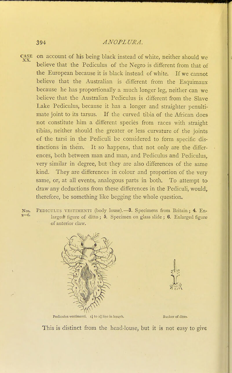 on account of his being black instead of white, neither should we believe that the Pediculus of the Negro is different from that of the European because it is black instead of white. If we cannot believe that the Australian is different from the Esquimaux because he has proportionally a much longer leg, neither can we believe that the Australian Pediculus is different from the Slave Lake Pediculus, because it has a longer and straighter penulti- mate joint to its tarsus. If the curved tibia of the African does not constitute him a different species from races with straight tibias, neither should the greater or less curvature of the joints of the tarsi in the Pediculi be considered to form specific dis- tinctions in them. It so happens, that not only are the differ- ences, both between man and man, and Pediculus and Pediculus, very similar in degree, but they are also differences of the same kind. They are differences in colour and proportion of the very same, or, at all events, analogous parts in both. To attempt to draw any deductions from these differences in the Pediculi, would, therefore, be something like begging the whole question. Pediculus vestimenti (body louse).—3. Specimens from Britain; 4. En- larged? figure of ditto ; 5. Specimen on glass slide ; 6. Enlarged figure of anterior claw. 6(v Pediculus vestimenti. ij to iJ line in length, Sucker of Jitto. This is distinct from the head-louse, but it is not easy to give