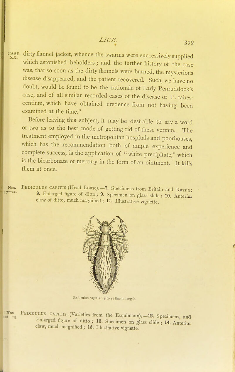 dirty flannel jacket, whence the swarms were successively supplied which astonished beholders ; and the further history of the case was, that so soon as the dirty flannels were burned, the mysterious disease disappeared, and the patient recovered. Such, we have no doubt, would be found to be the rationale of Lady Penruddock's case, and of all similar recorded cases of the disease of P. tabes- centium, which have obtained credence from not having been examined at the time. Before leaving this subject, it may be desirable to say a word or two as to the best mode of getting rid of these vermin. The treatment employed in the metropolitan hospitals and poorhouses, which has the recommendation both of ample experience and complete success, is the application of  white precipitate, which is the bicarbonate of mercury in the form of an ointment. It kills them at once. Not Pediculus capitis (Head Louse).-7. Specimens from Britain and Russia; 8. Enlarged figure of ditto; 9. Specimen on glass slide; 10. Anterior claw of ditto, much magnified; 11. Illustrative vignette. Pcdiculus capitis, j to i\line in lerg-.h. Nos as 15. ulus capitis (Varieties from the Esquimaux).-12. Specimens, and Enlarged figure of ditto ; 13. Specimen on glass slide ; 14. Anterior claw, much magnified; 15. Illustrative vignette.