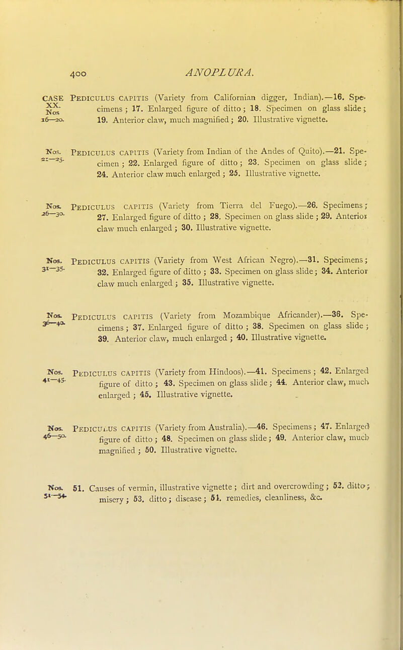 CASE Pediculus capitis (Variety from Californian digger, Indian).—16. Spe- jj^' cimens ; 17. Enlarged figure of ditto; 18. Specimen on glass slide ; 16—20. 19. Anterior claw, much magnified ; 20. Illustrative vignette. Nos. Pediculus capitis (Variety from Indian of the Andes of Quito).—21. Spe- cimen ; 22. Enlarged figure of ditto ; 23. Specimen on glass slide ; 24. Anterior claw much enlarged ; 25. Illustrative vignette. Nos. Pediculus capitis (Variety from Tierra del Fuego).—26. Specimens; 3° 27. Enlarged figure of ditto ; 28. Specimen on glass slide ; 29. Antcrioi claw much enlarged ; 30. Illustrative vignette. Nos. Pediculus capitis (Variety from West African Negro).—31. Specimens; ;I—3S 32. Enlarged figure of ditto ; 33. Specimen on glass slide; 34. Anterior claw much enlarged ; 35. Illustrative vignette. Nos- Pediculus capitis (Variety from Mozambique Africander).—36. Spe- |6_** cimens ; 37. Enlarged figure of ditto ; 38. Specimen on glass slide ; 39. Anterior claw, much enlarged ; 40. Illustrative vignette. Nos. Pkdiculus CAPITIS (Variety from Hindoos).—41. Specimens ; 42. Enlarged tI—45' figure of ditto ; 43. Specimen on glass slide ; 44. Anterior claw, much enlarged ; 45. Illustrative vignette. Nos. Pediculus CAPITIS (Variety from Australia).—46. Specimens; 47. Enlarged ,6~5P' figure of ditto ; 48. Specimen on glass slide; 49. Anterior claw, much magnified ; 50. Illustrative vignette. Nos. 51. Causes of vermin, illustrative vignette ; dirt and overcrowding ; 52. ditto; i,~54- misery; 53. ditto; disease; 51. remedies, cleanliness, &c