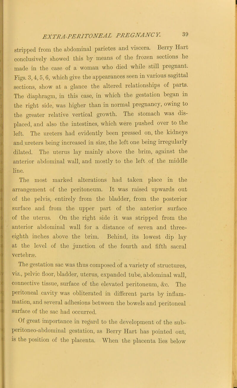 EXTRA-PERITONEAL PREGNANCY. stripped from the abdominal parietes and viscera. Beny Hart conclusively showed this by means of the frozen sections he made in the case of a woman who died while still pregnant. Figs. 3,4,5, 6, which give the appearances seen in various sagittal sections, show at a glance the altered relationships of parts. The diaphragm, in this case, in which the gestation began in the right side, was higher than in normal pregnancy, owing to the greater relative vertical growth. The stomach was dis- placed, and also the intestines, which were pushed over to the left. The ureters had evidently been pressed on, the kidneys and ureters being increased in size, the left one being irregularly dilated. The uterus lay mainly above the brim, against the anterior abdominal wall, and mostly to the left of the middle line. The most marked alterations had taken place in the arrangement of the peritoneum. It was raised upwards out of the pelvis, entirely from the bladder, from the posterior surface and from the upper part of the anterior surface of the uterus. On the right side it was stripped from the anterior abdominal wall for a distance of seven and three- eighth inches above the brim. Behind, its lowest dip lay at the level of the junction of the fourth and fifth sacral vertebrae. The gestation sac was thus composed of a variety of structures, viz., pelvic door, bladder, uterus, expanded tube, abdominal wall, connective tissue, surface of the elevated peritoneum, &c. The peritoneal cavity was obliterated in different parts by inflam- mation, and several adhesions between the bowels and peritoneal surface of the sac had occurred. Of great importance in regard to the development of the sub- peritoneo-abdominal gestation, as Berry Hart has pointed out, is the position of the placenta. When the placenta lies below