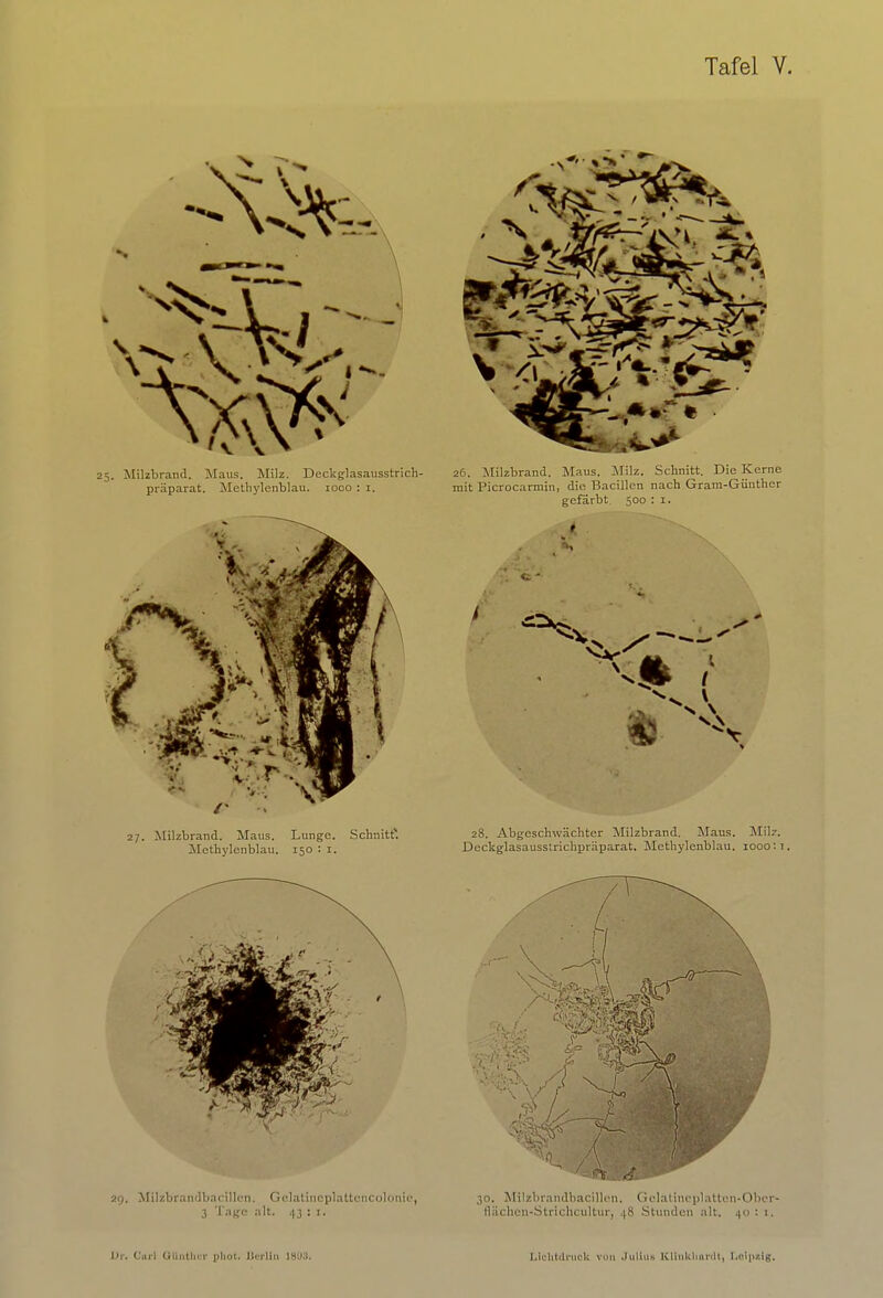 27. Milzbrand. Maus. Lunge. Schnitt* Methylenblau. 150 : 1. 29. Milzbrandbacillen. Gelatineplattencolonie, 3 Tage alt. 43 s 1. 26. Milzbrand. Maus. Milz. Schnitt. Die Kerne mit Picrocarmin, die Bacillen nach Gram-Günthcr gefärbt. 500 : 1. t 28. Abgeschwächter Milzbrand. Maus. Milz. Deckglasausstrichpräparat, Methylenblau. 1000:1. 30. Müzbrandbacillen. Gelatineplatten-Ober' Bächen-Strichcultur, ps Stunden alt. .| : 1,