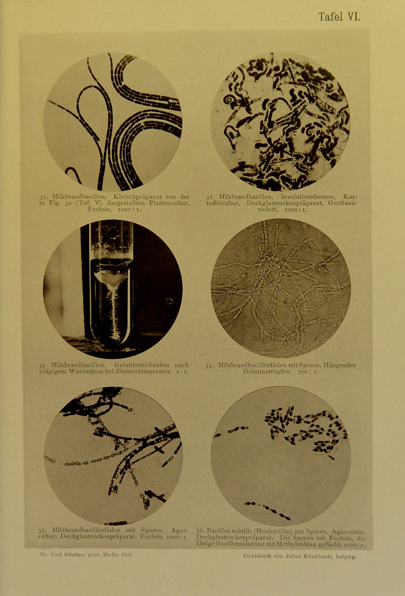 33. Milzbrandbacillen. Gelatinestichcultur nach 7tägigem Wachsthum bei Zimmertemperatur. 1:1. 35. Milzbrandbacillenfäden mit Sporen. Agnr- cultiir. Deckglastrockenpräparat. Fuchsin, 1000: 1, 34. Milzbrandbacillenfäden mitSporen. Hängender Gelatinetropfen. 500 : 1. 36. Bacillus subtilis (ITeubacillus) mit Sporen. Agarrultur. Deckglastrockcnpräparat. Dio Sporen mit Fuchsin, die übrige Bacillensupstanz mit Methylenblau gefärbt. 1000:1.