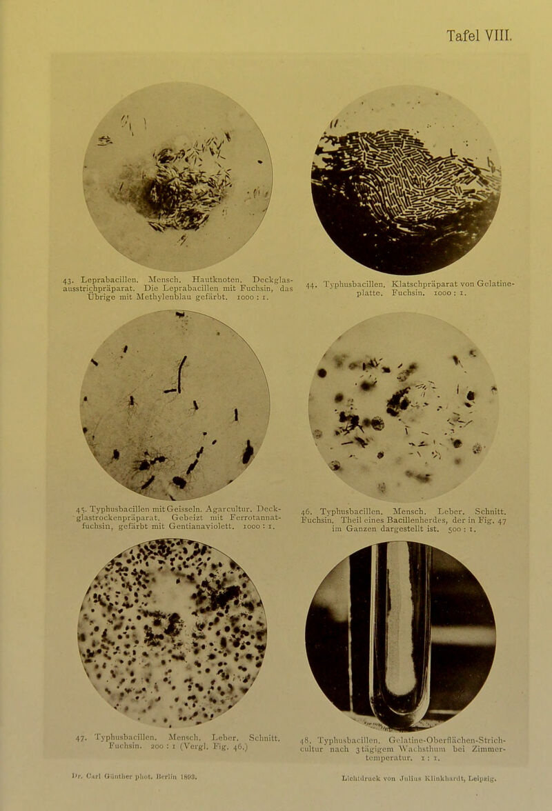 43. Leprabacillen. Mensch. Hautknoten. Dcckglas- ausstrichpräparat. Die Leprabacillen mit Fuchsin, das Übrige mit Methylenblau gefärbt. 1000 : 1. 4S. Typhusbacillen mit Geissein. Agarcultur. Deck- glastrockenpräparat. Gebeizt mit Fcrrotannat- fuchsin, gefärbt mit Gentianaviolett. 1000: 1. 47. Typhusbacillen. Mensch. Leber. Schnitt. Fuchsin. 200 : 1 (Vcrgl. Fig. 46.) Kr. Carl Günther phot, Berlin 18(«. 1/ 44. Typhusbacillen. Klatschpräparat von Gelatine- platte. Fuchsin. 1000: 1. 4 46. Typhusbacillen. Mensch. Leber. Schnitt. Fuchsin. Theil eines Bacillenherdes, der in Fii;. 47 im Ganzen dargestellt ist. 500 : 1. 48. Typhusbacillen. Grlatine-Oberflächen-Strich- cultur nach 3tägigem Wachsthum bei Zimmer- temperatur. 1:1.