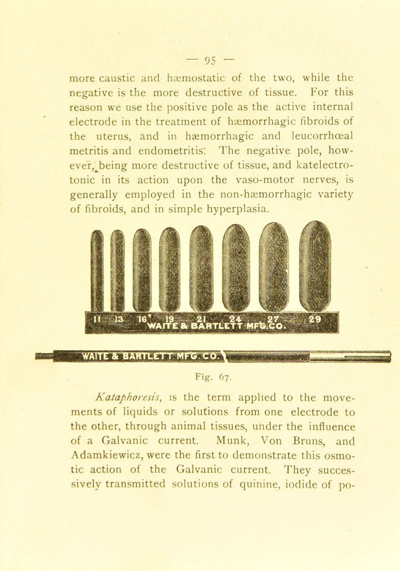 more caustic and haemostatic of the two, while the negative is the more destructive of tissue. For this reason we use the positive pole as the active internal electrode in the treatment of haemorrhagic fibroids of the uterus, and in haemorrhagic and leucorrhceal metritis and endometritis'. The negative pole, how- ever, being more destructive of tissue, and katelectro- tonic in its action upon the vaso-motor nerves, is generally employed in the non-haemorrhagic variety of fibroids, and in simple hyperplasia. WAITE anBARTLETT M Kataphoresis, is the term applied to the move- ments of liquids or solutions from one electrode to the other, through animal tissues, under the influence of a Galvanic current. Munk, Von Bruns, and Adamkiewicz, were the first to demonstrate this osmo- tic action of the Galvanic current. They succes- sively transmitted solutions of quinine, iodide of po- s