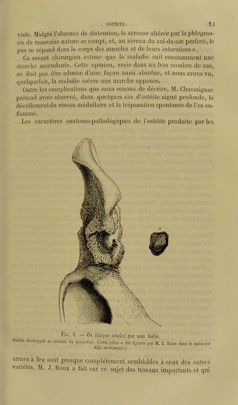 viale. Malgré l'absence de distension, la séreuse altérée par'laphlegma- sie de mauvaise nature se rompt, et, au niveau du cul-de-sac perforé, le pus se répand dans le corps des muscles et de leurs interstices ». Ce savant chirurgien estime que la maladie suit constamment une marche ascendante. Cette opinion, vraie dans un bon nombre de cas, ne doit pas être admise d'une façon aussi absolue, et nous avons vu, quelquefois, la maladie suivre une marche opposée. Outre les complications que nous venons de décrire, M. Chassaignac prétend avoir observé, dans quelques cas d'ostéite aiguë profonde, le décollementdu réseau médullaire et la trépanation spontanée de l'os en- flammé. Les caractères anatomo-pathologiques de l'ostéite produite par les Fie. II. — Os Iliaque atteint par une balle. Ostéite développée au contact du projectile. (Celle pièce a été tierce par M. J. Roux dans le mém,ire déjà mentionné.) armes à feu sont presque complètement semblables à ceux des autres variétés. M. J. Roux a fait sur ce sujet des travaux importants et qui