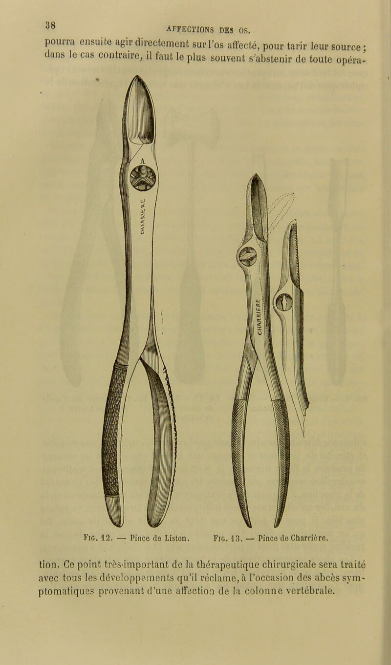 pourra ensuite agir directement sur l'os affecté, pour tarir leur source • dans le cas contraire, il faut le plus souvent s'abstenir de toute opéra' Fig. 12. — Pince de Liston. Fie. 13. — Pince de Charrièrc. tion. Ce point très-important do la thérapeutique chirurgicale sera traité avec tous les développements qu'il réclame, à l'occasion des abcès sym- ptomatiques provenant d'une affection de la colonne vertébrale.