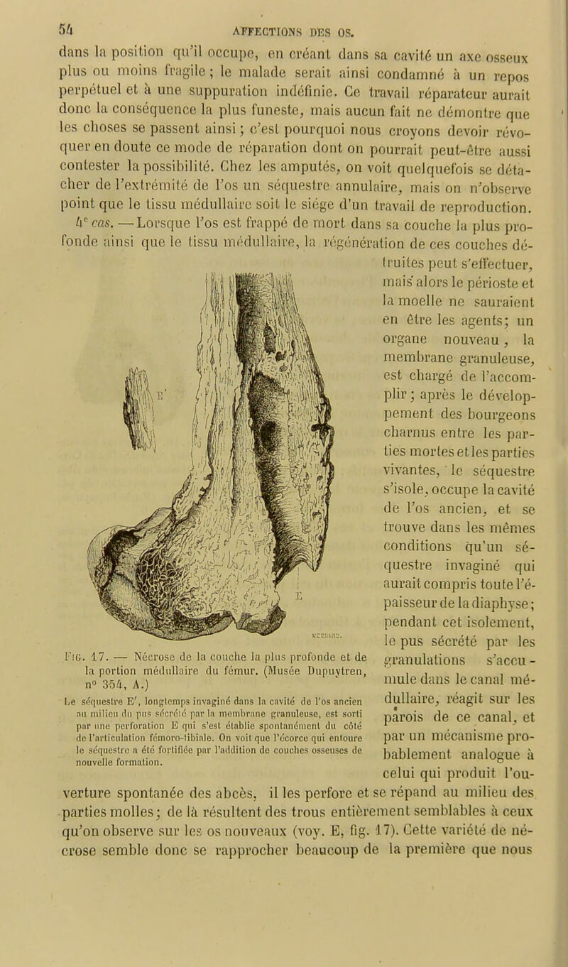 dans la position qu'il occupe, en créant dans sa cavité un axe osseux plus ou moins fragile ; le malade serait ainsi condamné à un repos perpétuel et à une suppuration indéfinie. Ce travail réparateur aurait donc la conséquence la plus funeste, mais aucun fait ne démontre que les choses se passent ainsi ; c'est pourquoi nous croyons devoir révo- quer en doute ce mode de réparation dont on pourrait peut-être aussi contester la possibilité. Chez les amputés, on voit quelquefois se déta- cher de l'extrémité de l'os un séquestre annulaire, mais on n'observe point que le tissu médullaire soit, le siège d'un travail de reproduction. V cas. — Lorsque l'os est frappé de mort dans sa couche la plus pro- fonde ainsi que le tissu médullaire, la régénération de ces couches dé- truites peut s'effectuer, mais alors le périoste et la moelle ne sauraient en être les agents; un organe nouveau , la membrane granuleuse, est chargé de l'accom- plir ; après le dévelop- pement des bourgeons charnus entre les par- ties mortes et les parties vivantes, ' le séquestre s'isole, occupe la cavité de l'os ancien, et se trouve dans les mêmes conditions qu'un sé- questre invaginé qui aurait compris toute l'é- paisseur de ladiaphyse; pendant cet isolement, le pus sécrété par les granulations s'accu - mule dans le canal mé- dullaire, réagit sur les parois de ce canal, et par un mécanisme pro- t'iG. 17. — Nécrose de la couche la plus profonde et de la portion médullaire du fémur. (Musée Dupuytren, n° 35/i, A.) Le séquestre E', longtemps invaginé dans la cavité de l'os ancien nu milieu du pus sécrété parla membrane granuleuse, est sorti par une perforation E qui s'est établie spontanément du côté de l'articulation fémoro-libinle. On voit que l'écorce qui entoure le séquestre a été fortifiée par l'addition de couebes osseuses de nouvelle formation. celui qui produit l'ou- verture spontanée des abcès, il les perfore et se répand au milieu des parties molles; de là résultent des trous entièrement semblables à ceux qu'on observe sur les os nouveaux (voy. E, fig. 17). Cette variété de né- crose semble donc se rapprocher beaucoup de la première que nous bablement analogue à