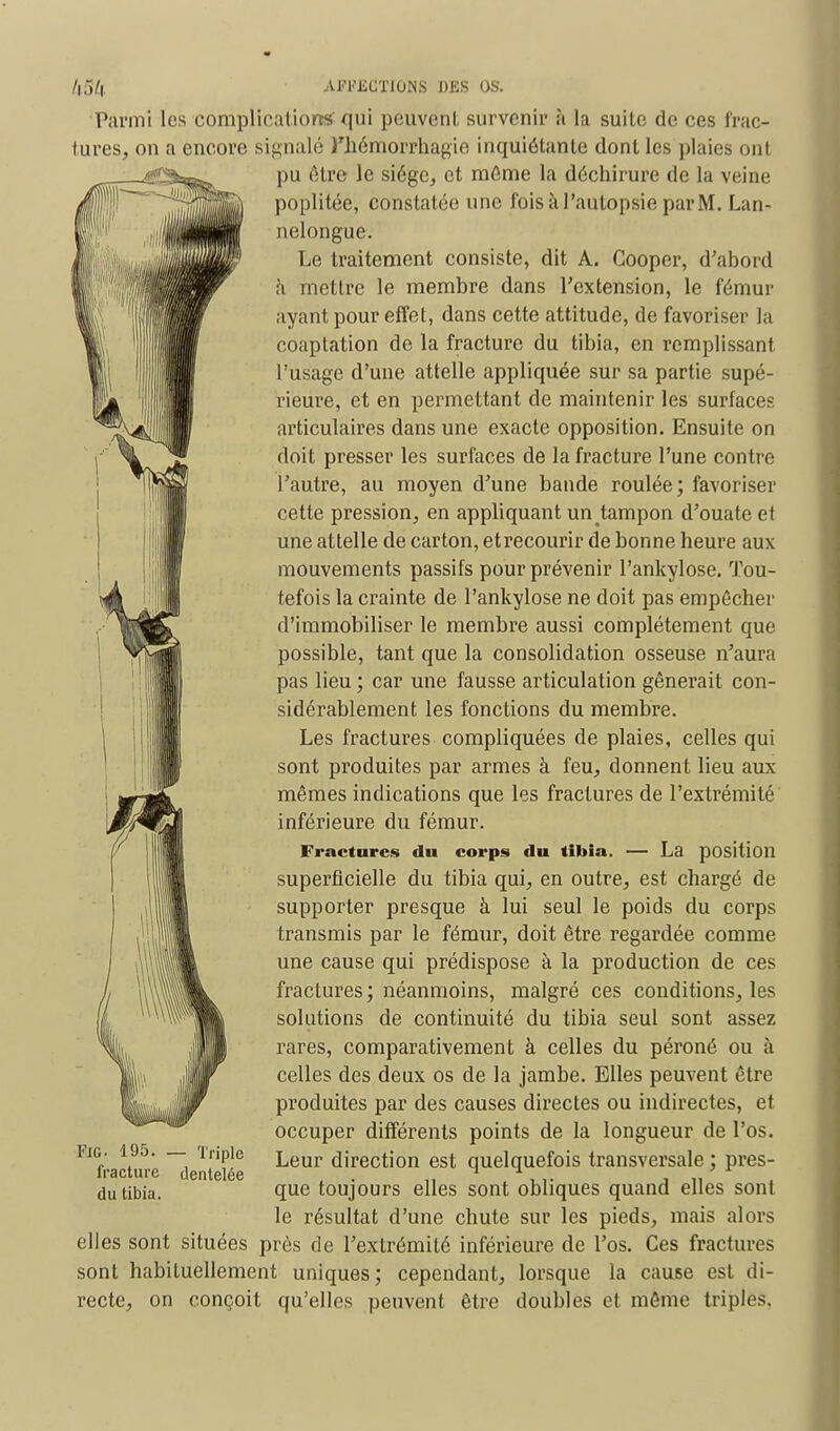 Parmi les complication*qui peuvent survenir à la suite de ces frac- tures, on a encore signalé Phémorrhagie inquiétante dont les plaies ont pu être le siège, et même la déchirure de la veine poplitée, constatée une fois à l'autopsie par M. Lan- nelongue. Le traitement consiste, dit A. Gooper, d'abord a mettre le membre dans l'extension, le fémur ayant pour effet, dans cette attitude, de favoriser la coaplation de la fracture du tibia, en remplissant l'usage d'une attelle appliquée sur sa partie supé- rieure, et en permettant de maintenir les surfaces articulaires dans une exacte opposition. Ensuite on doit presser les surfaces de la fracture l'une contre l'autre, au moyen d'une bande roulée; favoriser cette pression, en appliquant un tampon d'ouate et une attelle de carton, etrecourir de bonne heure aux mouvements passifs pour prévenir l'ankylose. Tou- tefois la crainte de l'ankylose ne doit pas empêcher d'immobiliser le membre aussi complètement que possible, tant que la consolidation osseuse n'aura pas lieu ; car une fausse articulation gênerait con- sidérablement les fonctions du membre. Les fractures compliquées de plaies, celles qui sont produites par armes à feu, donnent lieu aux mêmes indications que les fractures de l'extrémité inférieure du fémur. Fractures du corps du tibia. — La position superficielle du tibia qui, en outre, est chargé de supporter presque à lui seul le poids du corps transmis par le fémur, doit être regardée comme une cause qui prédispose à la production de ces fractures ; néanmoins, malgré ces conditions, les solutions de continuité du tibia seul sont assez rares, comparativement à celles du péroné ou à celles des deux os de la jambe. Elles peuvent être produites par des causes directes ou indirectes, et occuper différents points de la longueur de l'os. Leur direction est quelquefois transversale ; pres- que toujours elles sont obliques quand elles sont le résultat d'une chute sur les pieds, mais alors elles sont situées près de l'extrémité inférieure de l'os. Ces fractures sont habituellement uniques; cependant, lorsque la cause est di- recte, on conçoit qu'elles peuvent être doubles et même triples. 1 RIO. 195. _ Triple fracture dentelée du tibia.