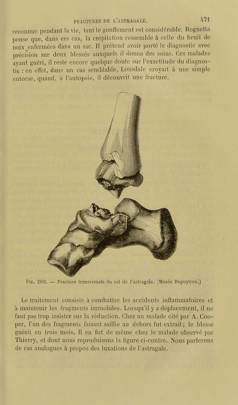 reconnue pendant la vie, tant le gonflement est considérable. Rognetta pense que, dans ces cas, la crépitation ressemble à celle du bruit de noix enfermées dans un sac. Il prétend avoir porté le diagnostic avec précision sur deux blessés auxquels il donna des soins. Ces malades ayant guéri, il reste encore quelque doute sur l'exactitude du diagnos- tic : en effet, clans un cas semblable, Lonsdale croyait à une simple entorse, quand, à l'autopsie, il découvrit une fracture. Fig. 203. — Fracture transversale du col de l'astragale. (Musée Dupuylren.) Le traitement consiste à combattre les accidents inflammatoires et à maintenir les fragmen ts immobiles. Lorsqu'il y a déplacement, il ne faut pas trop insister sur la réduction. Gbez un malade cité par A. Coo- per, l'un des fragments faisant saillie au dehors fut extrait; le blessé guérit en trois mois. Il en fut de môme chez le malade observé par Thierry, et dont nous reproduisons la ligure ci-contre. Nous parlerons de cas analogues à propos des luxations de l'astragale.