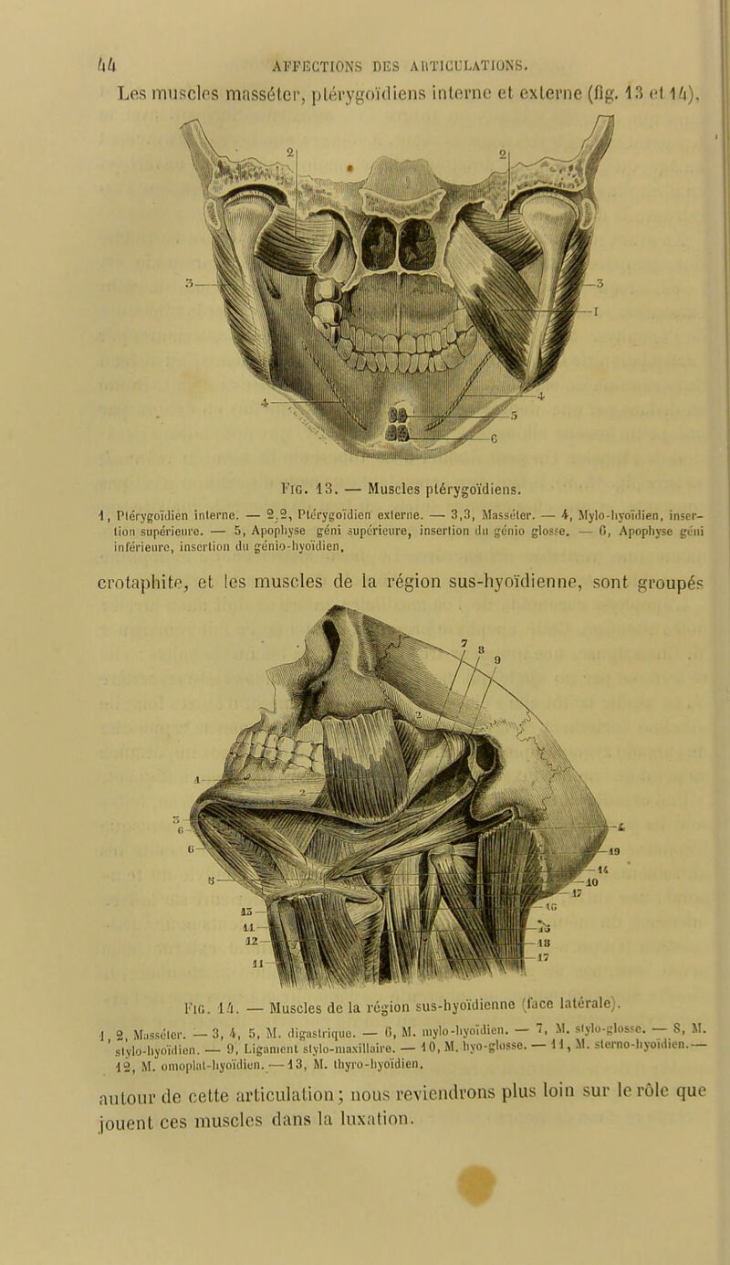 FÏG. 13. — Muscles plérygoïdiens. i, Plérygoïdien interne. — 2.2, Plérygoïdien externe. —■ 3,3, Masséler. — A, Mylo-hyoïdien, inser- lion supérieure. — 5, Apopliyse géni supérieure, insertion du génio glo?.-e. — G, Apophyse géni inférieure, insertion du génio-hyoïdien, crotaphite, et les muscles de la région sus-hyoïdienne, sont groupés l,-ir, _ Muscles de la région sus-hyoïdienne (face latérale). ] 2 Masséler. — 3, 4, 5, M. digaslriquo. — 6, M. mylb-hyoïdien. — 7. M. stylo-glosse. — S, M. ' stylo-hyoïdien. — 9, Ligament stylo-maxillaire. — 10, M. hyo-glosse. —Il,*, slerno-hyoïdien.— 12, M. omoplot-hyoïdien._—13, M. thyro-hyoïdien. autour de cette articulation; nous reviendrons plus loin sur le rôle que jouent ces muscles dans la luxation.