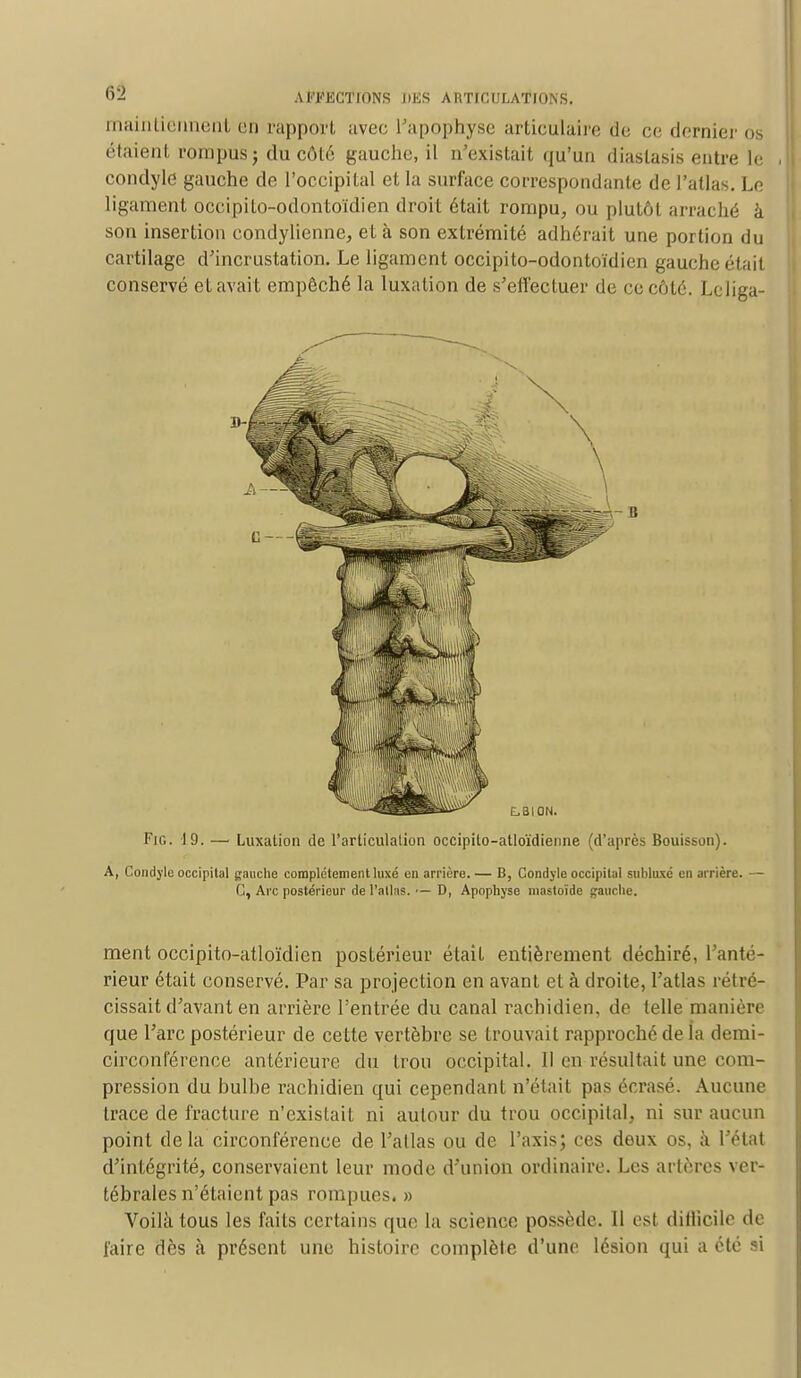 maintiennent en rapport avec l'apophyse articulaire de ce dernier os étaient rompus j du côt6 gauche, il n'existait qu'un diastasis entre Le condyle gauche de l'occipital et la surface correspondante de l'atlas. Le ligament occipilo-odontoïdien droit était rompu, ou plutôt arraché à son insertion condylienne, et à son extrémité adhérait une portion du cartilage d'incrustation. Le ligament occipito-odontoïdien gauche était conservé et avait empêché la luxation de s'effectuer de ce côté. Leliga- Fig. 19. — Luxation de l'articulation occipito-atloïdienne (d'après Bouisson). A, Condyle occipital gauche complètement luxé en arrière. — B, Condyle occipital subluxé en arrière. — C, Arc postérieur de l'allns. — D, Apophyse masloïde gauche. ment occipito-atloïdien postérieur était entièrement déchiré, l'anté- rieur était conservé. Par sa projection en avant et à droite, l'atlas rétré- cissait d'avant en arrière l'entrée du canal rachidien, de telle manière que l'arc postérieur de cette vertèbre se trouvait rapproché de la demi- circonférence antérieure du trou occipital. Il en résultait une com- pression du bulbe rachidien qui cependant n'était pas écrasé. Aucune trace de fracture n'existait ni autour du trou occipital, ni sur aucun point delà circonférence de l'atlas ou de l'axis; ces deux os, à l'état d'intégrité, conservaient leur mode d'union ordinaire. Les artères ver- tébrales n'étaient pas rompues. » Voilà tous les faits certains que la science possède. Il est dillicile de l'aire dès à présent une histoire complète d'une lésion qui a été si
