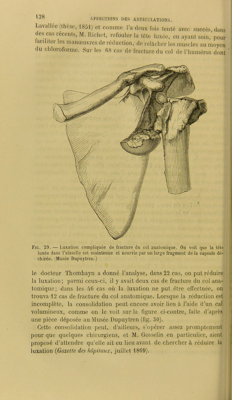 Lavallée (thèse, 1851) et comme l'a deux Ibis tenté avec succès, dans des cas récents, M. Ilichct, refouler la tote luxée, en ayant soin, pour Faciliter les manœuvres de réduction, de relâcher les muscles au moyen du chloroforme. Sur les 68 cas de fracture du col de l'humérus dont Fie. 29. — Luxation compliquée de fracture du col anatomique. On voit que la (ète luxée dans l'aisselle est maintenue et nourrie par un large fragment de la capsule dé- chirée. (Musée Dupuytren.) le docteur Thomhayn a donné l'analyse, dans 22 cas, on put réduire la luxation; parmi ceux-ci, il y avait deux cas de fracture du col ana- tomique; dans les 46 cas où la luxation ne put être effectuée, on trouva 12 cas de fracture du col anatomique. Lorsque la réduction est incomplète, la consolidation peut encore avoir lieu à l'aide d'un cal volumineux, comme on le voit sur la figure ci-contre, faite d'après une pièce déposée au Musée Dupuytren (fig. 30). Cette consolidation peut, d'ailleurs, s'opérer assez promptemenj pour que quelques chirurgiens, et M. Gosselin en particulier, aient proposé d'attendre qu'elle ait eu lieu avant de chercher à réduire la luxation (Gazette des hôpitaux, juillet 1869).