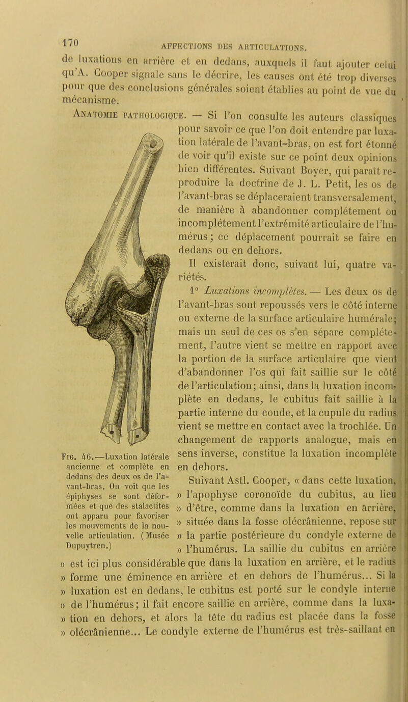 de luxations en arrière el. en dedans, auxquels il faut ajouter celui qu'A. Cooper signale sans le décrire, les causes ont été trop diverses pour que des conclusions générales soient établies au point de vue du mécanisme. Anatomie l'ATnoLOGiQUE. — Si l'on consulte les auteurs classiques pour savoir ce que l'on doit entendre par luxa- tion latérale de l'avant-bras, on est fort étonné de voir qu'il existe sur ce point deux opinions bien différentes. Suivant Boyer, qui paraît re- produire la doctrine de J. L. Petit, les os de Pavant-bras se déplaceraient transversalement, ; de manière à abandonner complètement ou incomplètement l'extrémité articulaire de l'hu- j mérus; ce déplacement pourrait se faire en dedans ou en dehors. Il existerait donc, suivant lui, quatre va-jî riétés. 1° Luxations incomplètes.— Les deux os de l'avant-bras sont repoussés vers le côté interne J ou externe de la surface articulaire humérale; mais un seul de ces os s'en sépare complète- j ment, l'autre vient se mettre en rapport ave» la portion de la surface articulaire que vient ! d'abandonner l'os qui fait saillie sur le côté : de l'articulation; ainsi, dans la luxation incon^j plète en dedans, le cubitus fait saillie à la partie interne du coude, et la cupule du radius vient se mettre en contact avec la trochlée. UrLi changement de rapports analogue, mais en ] sens inverse, constitue la luxation incomplète I en dehors. Suivant Asti. Cooper, « dans cette luxation, t » l'apophyse coronoïde du cubitus, au lieu ; » d'être, comme dans la luxation en arrière, ' » située dans la fosse olécrânienne, repose suwj » la partie postérieure du condyle externe de » l'humérus. La saillie du cubitus en arrière » est ici plus considérable que dans la luxation en arrière, et le radius » forme une éminence en arrière et en dehors de l'humérus... Si la » luxation est en dedans, le cubitus est porté sur le condyle interne » de l'humérus; il fait encore saillie en arrière, comme dans la luxa- » tion en dehors, et alors la tête du radius est placée dans la fosse » olécrânienne... Le condyle externe de l'humérus est très-saillant en Fig. 46.—Luxation latérale ancienne et complète en dedans des deux os de l'a- vant-bras. On voit que les épiphyses se sont défor- mées et que des stalactites ont apparu pour favoriser les mouvements de la nou- velle articulation. (Musée Dnpuylren.)