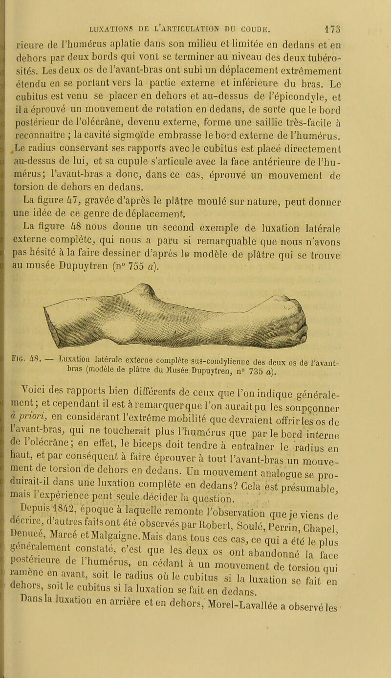 Heure de l'humérus aplatie dans son milieu et limitée en dedans et en dehors par deux bords qui vont se terminer au niveau des deuxtubéro- sités. Les deux os de l'avant-bras ont subi un déplacement extrêmement étendu en se portant vers la partie externe et inférieure du bras. Le cubitus est venu se placer en dehors et au-dessus de l'épicondyle, et il a éprouvé un mouvement de rotation en dedans, de sorte que le bord postérieur de l'olécrâne, devenu externe, forme une saillie très-facile à reconnaître ; la cavité sigmoïde embrasse le bord externe de l'humérus. Le radius conservant ses rapports avec le cubitus est placé directement au-dessus de lui,, et sa cupule s'articule avec la face antérieure de l'hu- mérus; l'avant-bras a donc, dans ce cas, éprouvé un mouvement de torsion de dehors en dedans. La figure hl, gravée d'après le plâtre moulé surnature, peut donner une idée de ce genre de déplacement. La figure 48 nous donne un second exemple de luxation latérale externe complète, qui nous a paru si remarquable que nous n'avons pas hésité à la faire dessiner d'après le modèle de plâtre qui se trouve au musée Dupuytren (n° 755 a). Fie. 48. — Luxation latérale externe complète sus-condylienne des deux os de l'avant- bras (modèle de plâtre du Musée Dupuytren, n° 735 a). Voici des rapports bien différents de ceux que l'on indique générale- ment; et cependant il est àremarquerque l'on auraitpu les soupçonner à priori, en considérant l'extrême mobilité que devraient offrir les os de l'avant-bras, qui ne toucherait plus Fhumérus que par le bord interne de l'olécrâne; en effet, le biceps doit tendre à entraîner le radius en haut, et par conséquent à faire éprouver à tout l'avant-bras un mouve- ment de torsion de dehors en dedans. Un mouvement analogue se pro- duirait-il dans une luxation complète en dedans? Cela est présumable mais l'expérience peut seule décider la question. Depuis 1842, époque à laquelle remonte l'observation que je viens de Écrire, d'autres faits ont été observés par Robert, Soulé, Perrin, Chanel Denucé, Marcé et Malgaigne.Mais dans tous ces cas, ce qui a été le plus généralement constaté, c'est que les deux os ont abandonné la lice posteneure de l'humérus, en cédant à un mouvement de torsion nu «mène en avant, soit le radius où le cubitus si la luxation se Z en dehors, soit le cubitus si la luxation se fait en dedans Dans la luxation en arrière et en dehors, Morel-Lavallée a observé les