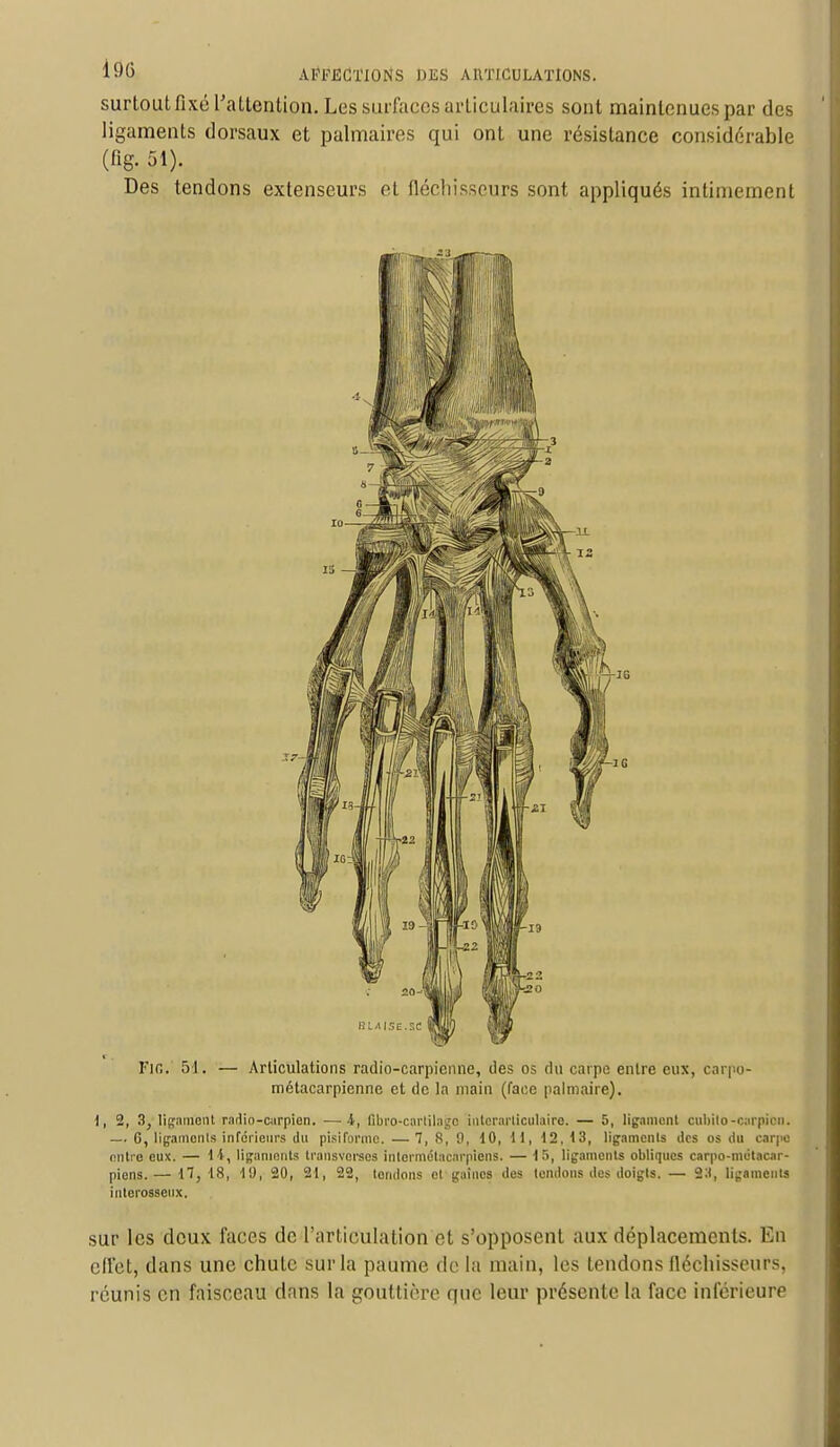 surtout fixé l'attention. Les surfaces articulaires sont maintenues par des ligaments dorsaux et palmaires qui ont une résistance considérable («g. 31). Des tendons extenseurs et fléchisseurs sont appliqués intimement Fin.' 51. — Articulations radio-carpienne, des os du carpe entre eux, carpo- métacarpienne et de ln main (face palmaire). I, 2, 3, ligament radio-carpien. ■—i, Qbro.-cnrlilago interarticulairc. — 5, ligament cubilo-carpien. — 0, ligaments inférieurs du pisiforme. — 7, 8, 9, 10, 11, 12,13, ligaments des os du carpe entre eux. — 14, ligaments transvorscs inlcrmétacarpicns. — l.r», ligaments obliques carpo-mëtacar- piens. — 17,18, 10, 20, 31, 22, tondons cl gaines des tendons des doigts. — 2:t, ligaments iuterosseux. sur les deux faces de l'articulation et s'opposent aux déplacements. En effet, dans une chute sur la paume de la main, les tendons fléchisseurs, réunis en faisceau dans la gouttière que leur présente la face inférieure