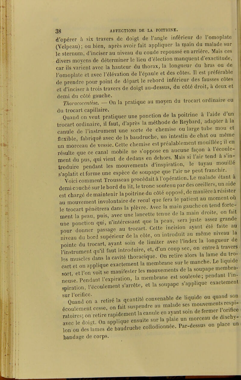 d'opérer fi six travers de doigt de l'angle inférieur de l'omoplate (Velpeau); ou bien, après avoir fait appliquer la main du malade sur le sternum, d'inciser au niveau du coude repoussé en arrière. Mais ces . divers moyens de déterminer le lieu d'élection manquent d'exactitude, car ils varient avec la hauteur du thorax, la longueur du bras ou de romoplate et avec l'élévation de l'épaule et des côtes. Il est préférable de prendre pour point de départ le rebord inférieur des fausses côtes et d'inciser à trois travers de doigt au-dessus, du côté droit, à deux et demi du côlé gauche. . Thoracocenièse. — On la pratique au moyen du trocarl ordmaire ou du trocart capillaire. Quand on veut pratiquer une ponction de la poitrine à 1 aide d un trocart ordinaire, il faut, d'après la méthode de Reybard, adapter à la canule de l'instrument une sorte de chemise ou large tube mou et flexible, fabriqué avec de la baudruche, un intestin de chat ou même un morceau de vessie. Cette chemise est préalablement mouillée; il en résulte que ce canal mobile ne s'oppose en aucune façon a 1 écoule- ment du pus, qui vient de dedans en dehors. Mais si l'air tend à s in- troduire pendant les mouvements d'inspiration, le tuyau mouille s'aplatit et forme une espèce de soupape que l'air ne peut franchir. ^ Voici comment Trousseau procédait à l'opération. Le malade étant a demi couché sur le bord du lit, le tronc soutenu par des oreillers un aide est chargé demaintenir lapoitrinedu côté opposé, de manière àresister au mouvement involontaire de recul que fera le patient au moment ou le trocart pénétrera dans la plèvre. Avec la main gauche on tend forte- ment la peau, puis, avec une lancette tenue de la main droite, on fait ne ponction' qui, n'intéressant que la peau, sera juste gr n e pour donner passage au trocarl. Cette incision ayan été faite au Niveau du bord supérieur de la côte, on introduit au - - a Tïointe du trocart, avant soin de limiter avec l'index la longueur de Crûment qu'il faut introduire, et, d'un coup sec. on entre à ravers s musdes cLs la cavité thoracique. On relire alors la lame u tro- cart e on applique exactement la membrane sur le manche. Le liquide 0 t lUvoi?se manifester les mouvements de la soupape memb a- neu^e Pendant l'expiration, la membrane est soulevée; pendant l n- ^Son l'écoulem'ent s'arrête, et la soupape s'applique exactement 'ouand on a retiré la quantité convenable de liquide ou quand son Quand on a reure ' » j ses mouvements respi- écoulement cesse, on fait suspendie au maiau . Voviûce r^tnires- on retire rapidement la canule en ayant soin de fermer i mince avec le do ^On pplique ensuite sur la plaie un morceau de diachy- îon ou desîames de baudruche collodionnée. Par-dessus on place un bandage de corps.