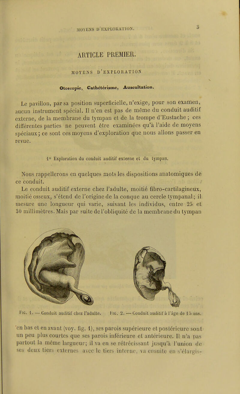 MU^liNS U'UXI'LOUATION. ARTICLE PREMIER. MOYENS d'exploration Otoscopie, Cathétérisme, Auscultation. Le pavillon, par sa position superficielle, n'exige, pour son examen, aucun instrument spécial. Il n'en est pas de môme du conduit auditif externe, de la membrane du tympan et de la trompe d'Eustache ; ces différentes parties ne peuvent Être examinées qu'à l'aide de moyens spéciaux; ce sont ces moyens d'exploration que nous allons passer en revue. 1 Exploration du conduit auditif externe et du tympan. Nous rappellerons en quelques mots les dispositions anatomiques de ce conduit. Le conduit auditif externe chez l'adulte, moitié fibro-cartilagineux, moitié osseux, s'étend de l'origine de la conque au cercle tympanal; il mesure une longueur qui varie, suivant les individus, entre 25 et 30 millimètres. Mais par suite de l'obliquité de la membrane du tympan Imu. 1. — Conduit auditif chez l'adulte. l' io. '2. — Conduit auditif à l'âge de 1» ans. 'en bas et en avant (voy. fig. 1), ses parois supérieure et postérieure sont un peu plus courtes que ses parois inférieure et antérieure. Il n'a pas partout la mûmc largueur; il va en se rétrécissant jusqu'à l'union de ses deux tiers externes avec le tiers inleine, va ensuite en s'clargis-