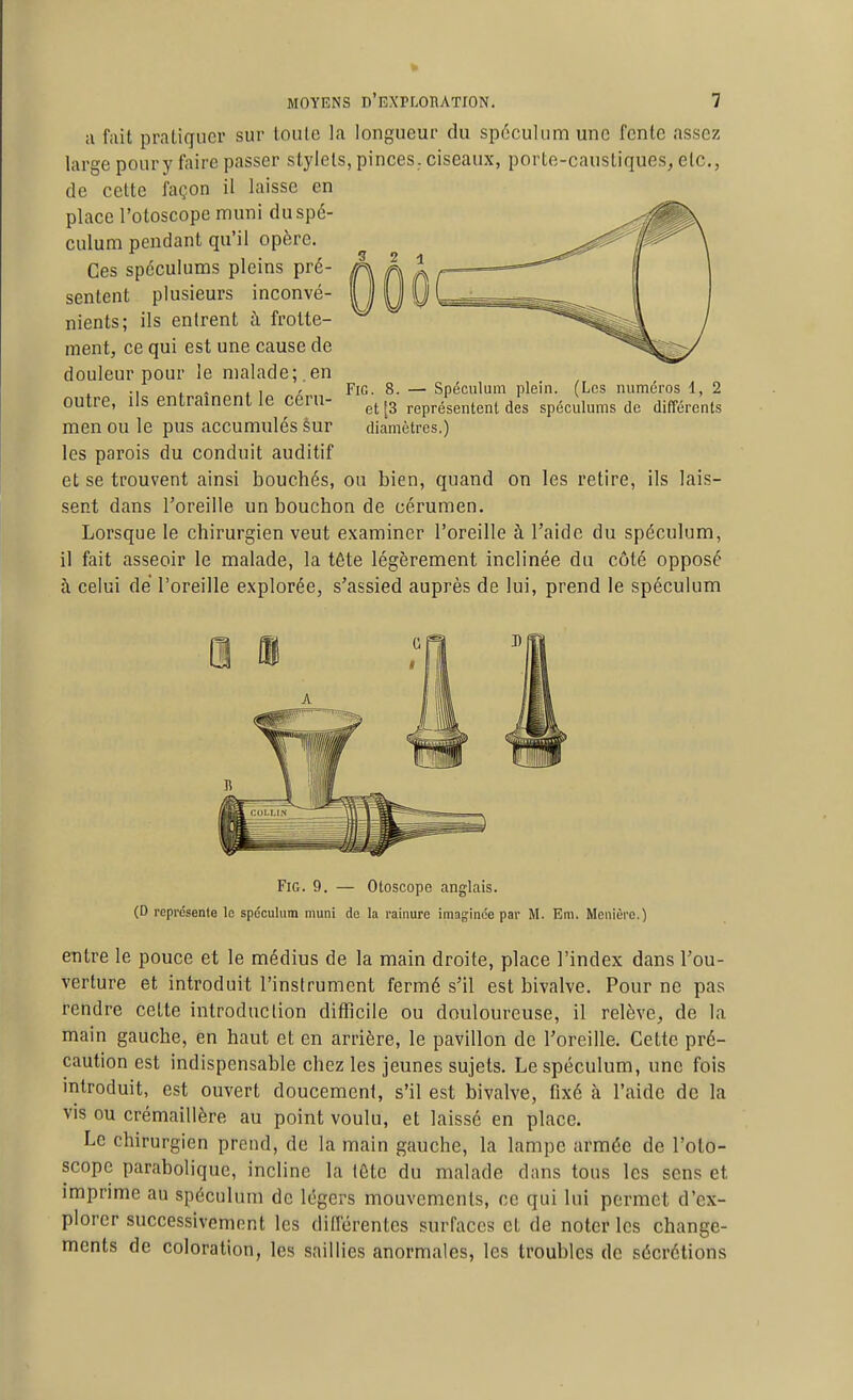 il fait pratiquer sur Inule la longueur du spéculum une fente assez large pour y taire passer stylets, pinces , ciseaux, porte-caustiques, etc., de cette façon il laisse en place l'otoscope muni du spé- culum pendant qu'il opère. Ces spéculums pleins pré- sentent plusieurs inconvé- nients; ils entrent à frotte- ment, ce qui est une cause de douleur pour le malade; .en outre, ils entraînent le céru- men ou le pus accumulés sur les parois du conduit auditif et se trouvent ainsi bouchés, ou bien, quand on les retire, ils lais- sent dans l'oreille un bouchon de cérumen. Lorsque le chirurgien veut examiner l'oreille à l'aide du spéculum, il fait asseoir le malade, la tête légèrement inclinée du côté opposé à celui de l'oreille explorée, s'assied auprès de lui, prend le spéculum FiG. 8. — Spéculum plein. (Los numéros 1, 2 et [3 représentent des spéculums de différents diamètres.) FiG. 9. — Otoscope anglais. (D représente le spéculum muni do la ramure imaginée par M. Em. Menière.) entre le pouce et le médius de la main droite, place l'index dans l'ou- verture et introduit l'instrument fermé s'il est bivalve. Pour ne pas rendre cette introduction difficile ou douloureuse, il relève, de la main gauche, en haut et en arrière, le pavillon de l'oreille. Cette pré- caution est indispensable chez les jeunes sujets. Le spéculum, une fois introduit, est ouvert doucement, s'il est bivalve, fixé à l'aide de la vis ou crémaillère au point voulu, et laissé en place. Le chirurgien prend, de la main gauche, la lampe armée de l'oto- scope parabolique, incline la lôtc du malade dans tous les sens et imprime au spéculum de légers mouvements, ce qui lui permet d'ex- plorer successivement les différentes surfaces et de noter les change- ments de coloration, les saillies anormales, les troubles de sécrétions