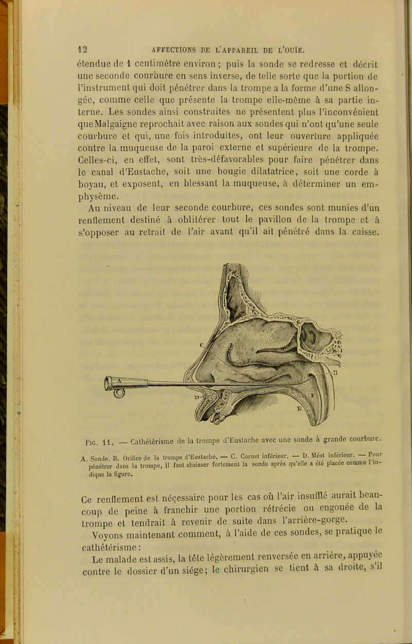 étendue de 1 ccnlimôtre environ; puis la sonde se redresse et décrit une seconde courbure en sens inverse, de telle sorte que la portion de l'instrument qui doit pénétrer dans la trompe a la forme d'une S allon- gée, comme celle que présente la trompe elle-même à sa partie in- terne. Les sondes ainsi construites ne présentent plus l'inconvénient queMalgaigne reprochait avec raison aux sondes qui n'ont qu'une seule coui'bure et qui, une fois introduites, ont leur ouverture appliquée contre la muqueuse de la paroi externe et supérieure de la trompe. Celles-ci, en effet, sont très-défavorables pour faire pénétrer dans le canal d'Eustaclie, soit une bougie dilatatrice, soit une corde à boyau, et exposent, en blessant la muqueuse, à déterminer un em- physème. Au niveau de leur seconde courbure, ces sondes sont munies d'un renilement destiné h oblitérer tout le pavillon de la trompe et à s'opposer au retrait de l'air avant qu'il ait pénétré dans la caisse. Pic. h, Calliélérisme de la U-ompe d'Euslache avec une sonde à grande courbure. A Sonde B. Orifice de la trompe d'Eustaclie. — C. Cornet inférieur. — D. Méat inférieur. — Pour pénétrer dans la trompe, il faut abaisser fortement la sonde après qu'elle a eto placée comice l in- dique la figure. Ce renflement est néçessairc pour les cas où l'air insufflé aurait beau- coup de peine à franchir une portion rélrécie ou engouée de la trompe et tendrait à revenir de suite dans l'arrière-gorge. Voyons maintenant comment, à l'aide de ces sondes, se pratique le c<itliét6risrn61 Le malade est assis, la tête légèrement renversée en arrière, appuyée contre le dossier d'un siège; le chirurgien se tient à sa droite, s'il