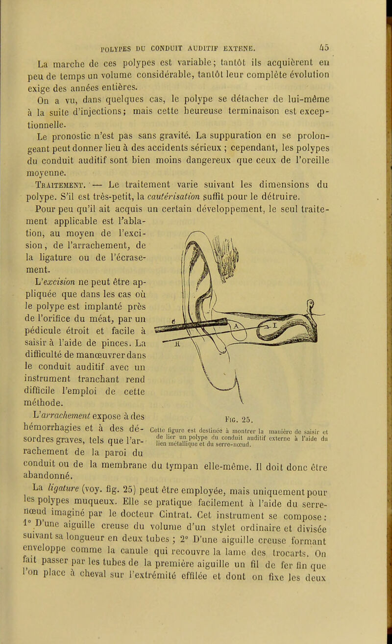 La marche de ces polypes est variable; tantôt ils acquièrent en peu de temps un volume considérable, tantôt leur complète évolution exige des années entières. On a vu, dans quelques cas, le polype se détacher de lui-même à la suite d'injections; mais cette heureuse terminaison est excep- tionnelle. Le pronostic n'est pas sans gravité. La suppuration en se prolon- geant peut donner lieu à des accidents sérieux ; cependant, les polypes du conduit auditif sont bien moins dangereux que ceux de l'oreille moyenne. Tbaitement, ■ — Le traitement varie suivant les dimensions du polype. S'il est très-petit, la cautérisation suffit pour le détruire. Pour peu qu'il ait acquis un certain développement, le seul traite- ment applicable est l'abla- tion, au moyen de l'exci- sion , de l'arrachement, de la ligature ou de l'écrase- ment. L'excision ne peut être ap- pliquée que dans les cas où le polype est implanté près de l'orifice du méat, par un pédicule étroit et facile à saisir à l'aide de pinces. La difficulté de manœuvrer dans le conduit auditif avec un instrument tranchant rend difficile l'emploi de cette méthode. h'arrachement expose à des hémorrhagies et à des dé- sordres graves, tels que l'ar- rachement de la paroi du conduit ou de la membrane du tympan elle-même. Il doit donc être abandonné. La ligature (voy. fig. 25) peut être employée, mais uniquement pour les polypes muqueux. Elle se pratique facilement à l'aide du serre- nœud imaginé par le docteur Cintrât. Cet instrument se compose: 1° D'une aiguille creuse du volume d'un stylet ordinaire et divisée suivant sa longueur en deux tubes ; 2° D'une aiguille creuse formant enveloppe comme la canule qui recouvre la lame des trocarts. On fait passer par les tubes de la première aiguille un fil de fer fin que 1 on place î\ cheval sur l'extrémité effilée et dont on fixe Jcs deux l'iG. 25. Celle ligure esl desliiiéo à nionlrer la inaiiièrc do saisii- el de lier un polype du conduit audilif externe à l'aide du lien niélallique et du serre-nœud.