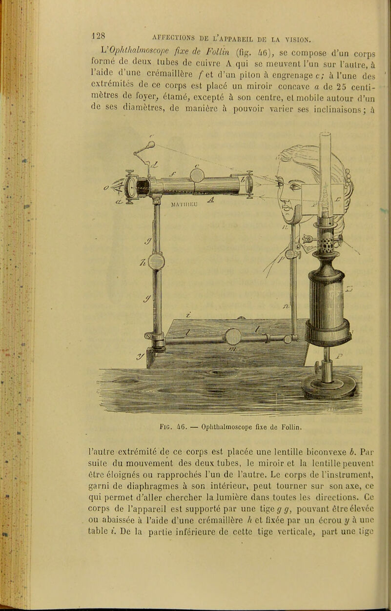 h'Ophthalmoscope fixe de Follin {ïi^. se compose d'un corps formé de deux tubes de cuivre A qui se meuvent l'un sur l'autre, à l'aide d'une crémaillère /et d'un pilon ;\ engrenage c; à l'une des extrémités de ce corps est placé un miroir concave a de 25 centi- mètres de foyer, étamé, excepté à son centre, et mobile autour d'un de ses diamètres, de manière à pouvoir varier ses inclinaisons; à FiG. 46. — Ophthalmoscope fixe de Follin. l'autre extrémité de ce corps est placée une lentille biconvexe b. Par suile du mouvement des deux tubes, le miroir et la lentille peuvent être éloignés ou rapprochés l'un de l'autre. Le corps de l'instrument, garni de diaphragmes à son intérieur, peut tourner sur son axe, ce qui permet d'aller chercher la lumière dans toutes les directions. Ce corps de l'appareil est supporté par une W^agg, pouvant être élevée ou abaissée à l'aide d'une crémaillère // et flxée par un écrou y à uno table i. De la partie inférieure de cette tige verticale, part une tigi'