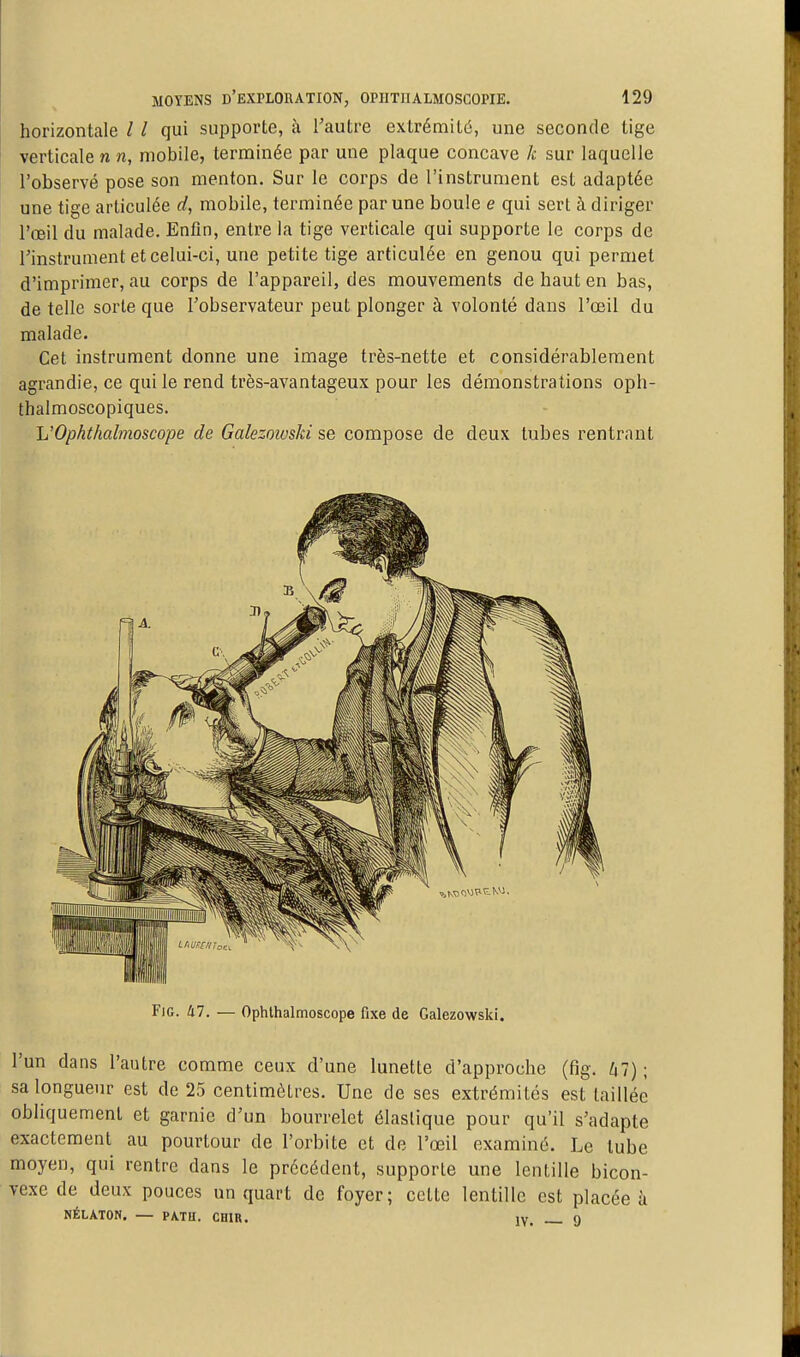 horizontale / / qui supporte, à l'autre extrémité, une seconde tige verticale n n, mobile, terminée par une plaque concave A- sur laquelle l'observé pose son menton. Sur le corps de l'instrument est adaptée une tige articulée d, mobile, terminée par une boule e qui sert à diriger l'œil du malade. Enfin, entre la tige verticale qui supporte le corps de l'instrument et celui-ci, une petite tige articulée en genou qui permet d'imprimer, au corps de l'appareil, des mouvements de haut en bas, de telle sorte que l'observateur peut plonger à volonté dans l'œil du malade. Cet instrument donne une image très-nette et considérablement agrandie, ce qui le rend très-avantageux pour les démonstrations oph- thalmoscopiques. L'Opht/ialmoscope de Galezoïvski se compose de deux tubes rentrant FiG. lil. — Ophthalmoscope fixe de Galezowski. l'un dans l'autre comme ceux d'une lunette d'approche (fig. hl) ; sa longueur est de 25 centimètres. Une de ses extrémités est taillée obliquement et garnie d'un bourrelet élastique pour qu'il s'adapte exactement au pourtour de l'orbite et de l'œil examiné. Le tube moyen, qui rentre dans le précédent, supporte une lentille bicon- vexe de deux pouces un quart de foyer; cette lentille est placée à NÉLATON. — PATU. CHIR. iv 0