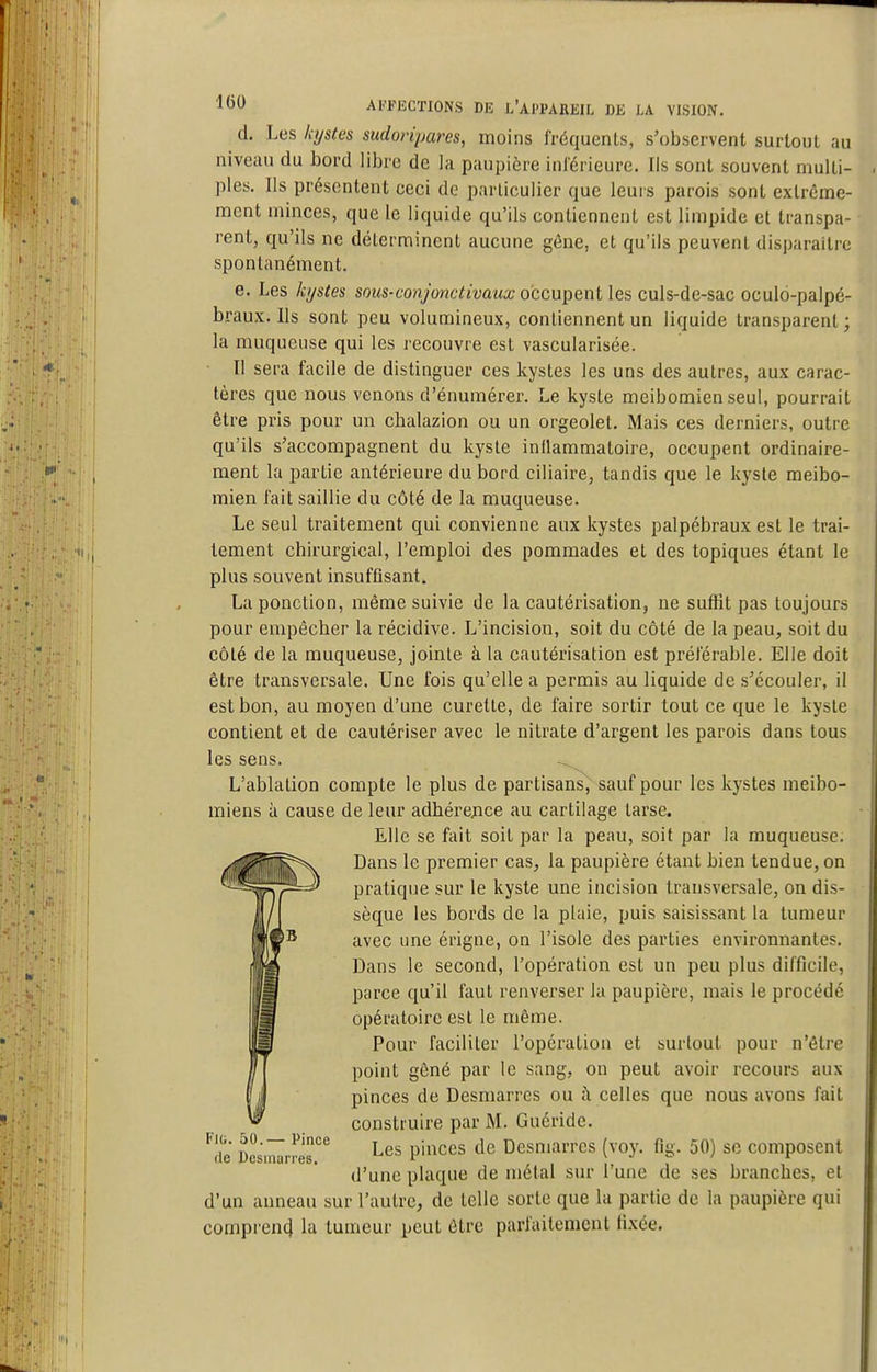 d. Les kystes sudoripares, moins fréquents, s'observent surtout au niveau du bord libre de la paupière inl'érieure. Ils sont souvent multi- ples. Ils présentent ceci de particulier que leurs parois sont extrême- ment minces, que le liquide qu'ils contiennent est limpide et transpa- rent, qu'ils ne déterminent aucune gêne, et qu'ils peuvent disparaître spontanément. e. Les kystes sows-tortyonc^ryawa.'occupent les culs-de-sac oculo-palpé- braux. Ils sont peu volumineux, contiennent un liquide transparent; la muqueuse qui les recouvre est vascularisée. Il sera facile de distinguer ces kystes les uns des autres, aux carac- tères que nous venons d'énumérer. Le kyste meibomien seul, pourrait être pris pour un chalazion ou un orgeolet. Mais ces derniers, outre qu'ils s'accompagnent du kyste inllammatoire, occupent ordinaire- ment la partie antérieure du bord ciliaire, tandis que le kyste meibo- mien fait saillie du côté de la muqueuse. Le seul traitement qui convienne aux kystes palpébraux est le trai- tement chirurgical, l'emploi des pommades et des topiques étant le plus souvent insuffisant. La ponction, même suivie de la cautérisation, ne suffit pas toujours pour empêcher la récidive. L'incision, soit du côté de la peau, soit du côté de la muqueuse, jointe à la cautérisation est préférable. Elle doit être transversale. Une fois qu'elle a permis au liquide de s'écouler, il est bon, au moyen d'une curette, de faire sortir tout ce que le kyste contient et de cautériser avec le nitrate d'argent les parois dans tous les sens. L'ablation compte le plus de partisans, sauf pour les kystes meibo- miens à cause de leur adhérence au cartilage tarse. Elle se fait soit par la peau, soit par la muqueuse. Dans le premier cas, la paupière étant bien tendue, on pratique sur le kyste une incision transversale, on dis- sèque les bords de la plaie, puis saisissant la tumeur avec une érigne, on l'isole des parties environnantes. Dans le second, l'opération est un peu plus difficile, parce qu'il faut renverser la paupière, mais le procédé opératoire est le même. Pour faciliter l'opération et surtout pour n'être point gêné par le sang, on peut avoir recours aux pinces de Desmarres ou ù, celles que nous avons fait construire par M. Guéride. Les pinces de Desmarres (voy. fig. 50) se composent d'une plaque de métal sur l'une de ses branches, et d'un anneau sur l'autre, de telle sorte que la partie de la paupière qui comprend la tumeur peut être parfaitement fixée. FlG. 50.— Pince de Desmarres.