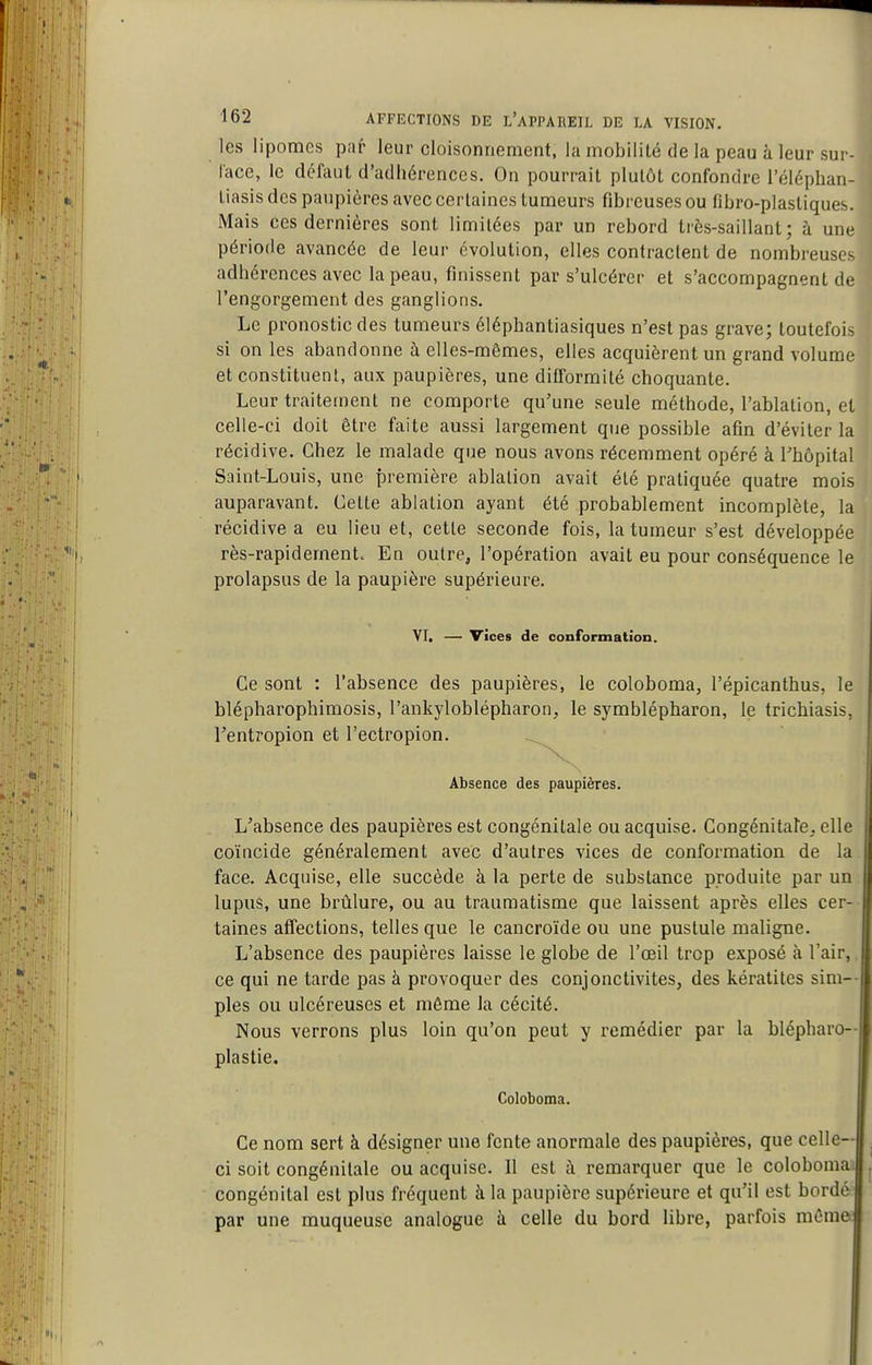 les lipomes par leur cloisonnement, la mobilité de la peau à leur sur- lace, le défaut d'adhérences. On pourrait plutôt confondre l'éléphan- liasis des paupières avec certaines tumeurs fibreuses ou tibro-plastiques. Mais ces dernières sont limitées par un rebord très-saillant; à une période avancée de leur évolution, elles contractent de nombreuses adhérences avec la peau, finissent par s'ulcérer et s'accompagnent de l'engorgement des ganglions. Le pronostic des tumeurs éléphantiasiques n'est pas grave; toutefois si on les abandonne à elles-mêmes, elles acquièrent un grand volume et constituent, aux paupières, une difformité choquante. Leur traitement ne comporte qu'une seule méthode, l'ablation, et celle-ci doit être faite aussi largement que possible afin d'éviter la récidive. Chez le malade que nous avons récemment opéré à Thopital Saint-Louis, une première ablation avait été pratiquée quatre mois auparavant. Cette ablation ayant été probablement incomplète, la récidive a eu lieu et, cette seconde fois, la tumeur s'est développée rès-rapidernent. En outre, l'opération avait eu pour conséquence le prolapsus de la paupière supérieure. Ce sont : l'absence des paupières, le coloboma, l'épicanthus, le blépharophimosis, l'ankyloblépharon, le symblépharon, le trichiasis, Fentropion et l'ectropion. L'absence des paupières est congénitale ou acquise. Congénitare, elle coïncide généralement avec d'autres vices de conformation de la face. Acquise, elle succède à la perte de substance produite par un lupus, une brûlure, ou au traumatisme que laissent après elles cer- taines affections, telles que le cancroïde ou une pustule maligne. L'absence des paupières laisse le globe de l'œil trop exposé à l'air,. ce qui ne tarde pas à provoquer des conjonctivites, des kératites sim- ples ou ulcéreuses et même la cécité. Nous verrons plus loin qu'on peut y remédier par la blépharo- plastie. Ce nom sert à désigner une fente anormale des paupières, que celle- ci soit congénitale ou acquise. 11 est à remarquer que le coloboma: congénital est plus fréquent à la paupière supérieure et qu'il est bordé par une muqueuse analogue à celle du bord libre, parfois mûme^ VI, — vices de conformation. Absence des paupières. Coloboma.