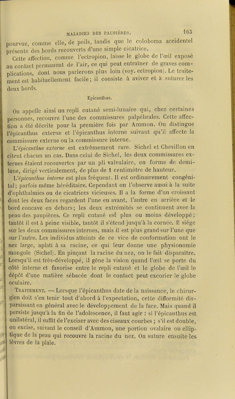 pourvue, comme elle, de poils, landis que le coloboma accidentel présente des bords recouverts d'une simple cicatrice. Cette affection, comme l'ectropion, laisse le globe de l'œil exposé au contact permanent de l'air, ce qui peut entraîner de graves com- plications, dont nous parlerons plus loin (voy. ectropion). Le traite- ment est habituellement facile; il consiste à aviver et à suturer les deux bords. Epicanthus. On appelle ainsi un repli cutané semi-lunaire qui, chez certaines personnes, recouvre l'une des commissures palpébrales. Celte affec- tion a été décrite pour la première fois par Ammon. On distingue l'épicanthus externe et l'épicanthus interne suivant qu'il affecte la commissure externe ou la commissure interne. L'épicanthus externe est extrêmement rare. Sichel et Chevillon en citent chacun un cas. Dans celui de Sichel, les deux commissures ex- ternes étaient recouvertes par un pli valvulaire, en forme de demi- lune, dirigé verticalement, de plus de 1 centimètre de hauteur. L'épicanthus interne est plus fréquent. Il est ordinairement congéni- tal; parfois même héréditaire. Cependant on Tobserve aussi à la suite d'ophthalmies ou de cicatrices vicieuses. Il a la forme d'un croissant dont les deux faces regardent l'une en avant, l'autre en arrière et le bord concave en dehors; les deux extrémités se continuent avec la peau des paupières. Ce repli cutané est plus ou moins développé ; tantôt il est à peine visible, tantôt il s'étend jusqu'à la cornée. Il siège sur les deux commissures internes, mais il est plus grand sur l'une que sur l'autre. Les individus atteints de ce vice de conformation ont le nez large, aplati à sa racine, ce qui leur donne une physionomie mongole (Sichel). En pinçant la racine du nez, on le fait disparaître. Lorsqu'il est très-développé, il gêne la vision quand l'œil se porte du côté interne et favorise entre le repli cutané et le globe de l'œil le dépôt d'une matière sébacée dont le contact peut excorier le globe oculaire. Traitement. —Lorsque l'épicanthus date de la naissance, le chirur- gien doit s'en tenir tout d'abord à l'expectation, cette difformité dis- paraissant en général avec le développement de la face. Mais quand il persiste jusqu'à la fin de l'adolescence, il faut agir : si l'épicanthus est unilatéral, il suffit de l'exciser avec des ciseaux courbes ; s'il est double, on excise, suivant le conseil d'Ammon, une portion ovalaire ou ellip- tique de la peau qui recouvre la racine du nez. On suture ensuite les lèvres de la plaie.