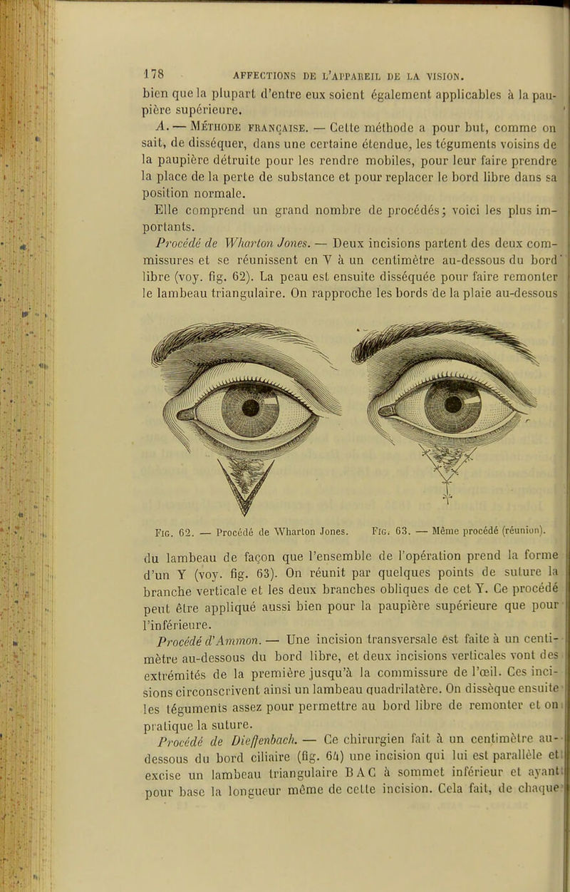 bien que la plupart d'entre eux soient également applicables à la pau- pière supérieure. A. — MÉTHODE FRANÇAISE. — Celle méthode a pour but, comme on sait, de disséquer, dans une certaine étendue, les téguments voisins de la paupière détruite pour les rendre mobiles, pour leur faire prendre la place de la perte de substance et pour replacer le bord libre dans sa position normale. Elle comprend un grand nombre de procédés; voici les plus im- portants. Procédé de Wharton Jones. — Deux incisions partent des deux com- missures et se réunissent en V à un centimètre au-dessous du bord libre (voy. fig. 62). La peau est ensuite disséquée pour faire remonter le lambeau triangulaire. On rapproche les bords de la plaie au-dessous Fig. 62. — Procédé de Wharlon Jones. Fig. 63. — Même procédé (réunion). du lambeau de façon que l'ensemble de l'opération prend la forme d'un y (voy. fig. 63). On réunit par quelques points de sulure la branche verticale et les deux branches obliques de cet Y. Ce procédé peut être appliqué aussi bien pour la paupière supérieure que pour • l'inférieure. Procédé d'Ammon. — Une incision transversale êst faite à un cenli- ■ mètre au-dessous du bord libre, et deux incisions verticales vont des • extrémités de la première jusqu'à la commissure de l'œil. Ces inci- sions circonscrivent ainsi un lambeau quadrilatère. On dissèque ensuite les téguments assez pour permettre au bord libre de remonter cl om pratique la suture. Procédé de Diefjenbach. — Ce chirurgien fait à un centimètre au-- dessous du bord ciliaire (fig. 64) une incision qui lui est parallèle eti excise un lambeau triangulaire BAC à sommet inférieur et ayanti pour base la longueur même de celte incision. Cela fait, de chaque?