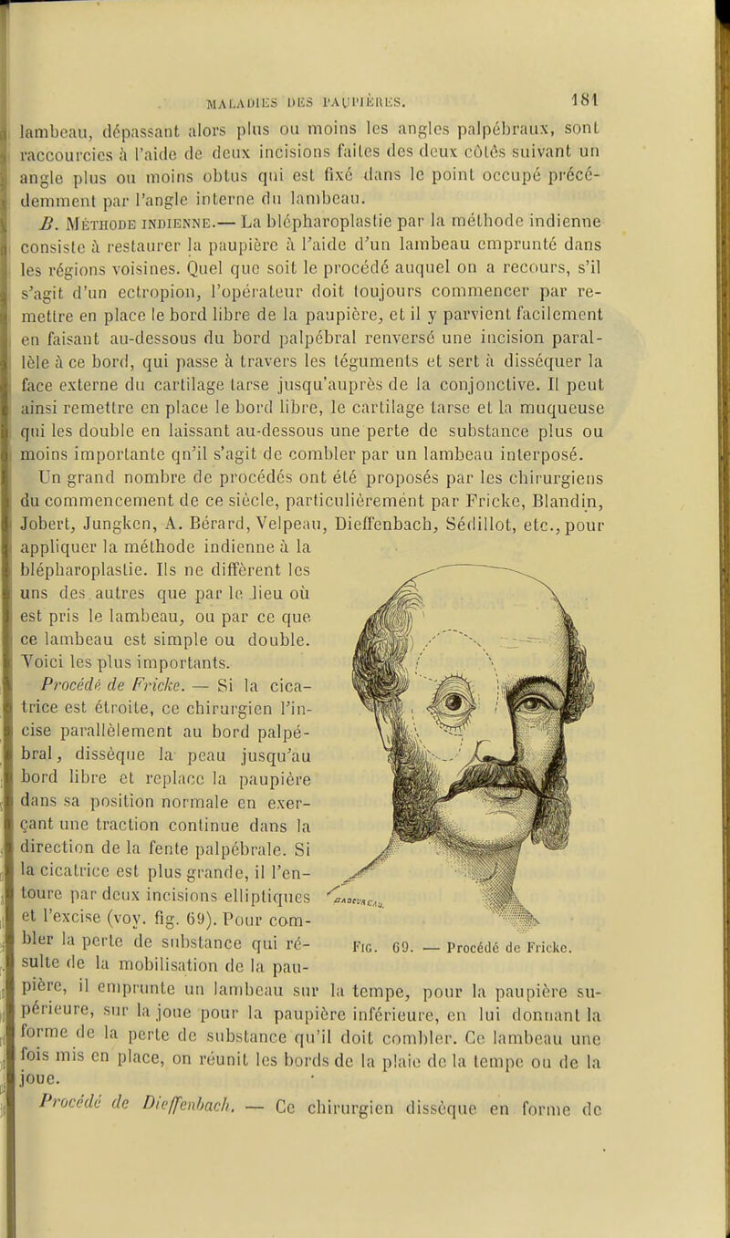 lambeau, dépassant alors plus ou moins les angles palpébraux, sont raccourcies à l'aide de deux incisions faites des deux côtés suivant un angle plus ou moins obtus qui est fixé dans le point occupé précc- denimenl par l'angle interne du lambeau. £. Méthode indienne.— La blépharoplastie par la méthode indienne consiste à restaurer la paupière à l'aide d'un lambeau emprunté dans les régions voisines. Quel que soit le procédé auquel on a recours, s'il s'agit d'un ectropion, l'opérateur doit toujours commencer par re- mettre en place le bord libre de la paupière^ et il y parvient facilement en faisant au-dessous du bord palpébral renversé une incision paral- lèle à ce bord, qui passe à travers les téguments et sert à disséquer la face externe du cartilage larse jusqu'auprès de la conjonctive. Il peut ainsi remettre en place le bord libre, le cartilage tarse et la muqueuse qui les double en laissant au-dessous une perte de substance plus ou moins importante qu'il s'agit de combler par un lambeau interposé. Un grand nombre de procédés ont été proposés par les chirurgiens du commencement de ce siècle, particulièrement par Fricke, Blandin, Jobert, Jungken, A. Bérard, Velpeau, Dieffenbacb, Sédillot, etc., pour appliquer la méthode indienne à la blépharoplastie. Ils ne diffèrent les uns des, autres que parle lieu où est pris le lambeau, ou par ce que ce lambeau est simple ou double. Voici les plus importants. Procédé de Fricke. — Si la cica- trice est étroite, ce chirurgien l'in- cise parallèlement au bord palpé- bral, dissèque la- peau jusqu'au bord libre et replace la paupière dans sa position normale en exer- çant une traction continue dans la direction de la fente palpébrale. Si la cicatrice est plus grande, il l'en- toure par deux incisions elliptiques et l'excise (voy. fig. 69). Pour com- bler la perle de sidistance qui ré- sulte de la mobilisation de la pau- pière, il emprunte un lambeau sur périeure, sur la joue pour la paupière inférieure, en lui donnant la forme de la perte de substance qu'il doit combler. Ce lambeau une fois mis en place, on réunit les bords de la plaie de la tempe ou de la joue. Procède de Dieffenhacli. — Ce chirurgien dissèque en forme de Fig. C9. — Procédé de Fricke. la tempe, pour la paupière su-