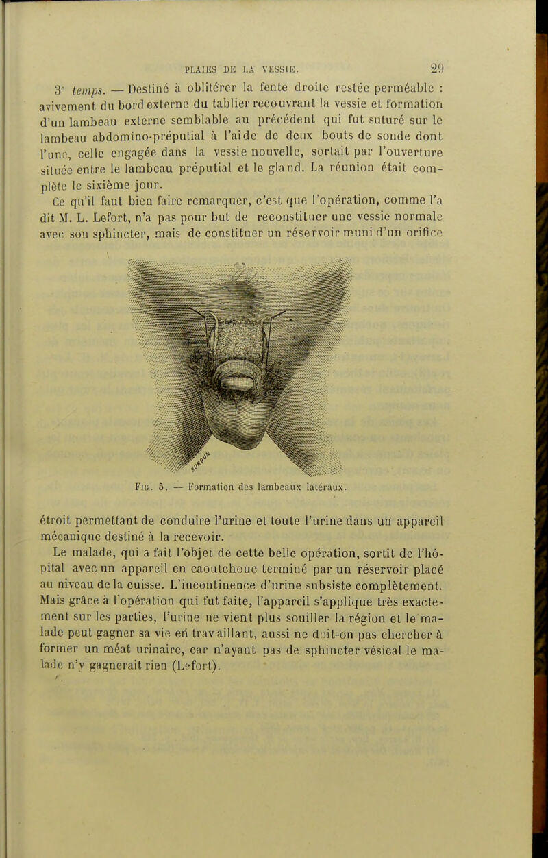 3= temps. — Destiné à oblitérer la fente droite restée perméable : aviveraent du bord externe du tablier recouvrant la vessie et formation d'un lambeau externe semblable au précédent qui fut suturé sur le lambeau abdomino-préputial h l'aide de deux bouts de sonde dont l'uno, celle engagée dans la vessie nouvelle, sortait par l'ouverture située entre le lambeau préputial et le gland. La réunion était com- plète le sixième jour. Ce qu'il faut bien faire remarquer, c'est que l'opération, comme l'a dit M. L. Lefort, n'a pas pour but de reconstituer une vessie normale avec son sphincter, mais de constituer un réservoir m.uni d'un orifice FiG. 5. — Formation des lambeaux latéraux. étroit permettant de conduire l'urine et toute l'urine dans un appareil mécanique destiné h la recevoir. Le malade, qui a fait l'objet de cette belle opération, sortit de l'hô- pital avec un appareil en caoutchouc terminé par un réservoir placé au niveau delà cuisse. L'incontinence d'urine subsiste complètement. Mais grâce à l'opération qui fut faite, l'appareil s'applique très exacte- ment sur les parties, l'urine ne vient plus souiller la région et le ma- lade peut gagner sa vie eh travaillant, aussi ne doit-on pas chercher à former un méat urinaire, car n'ayant pas de sphincter vésical le ma- lade n'y gagnerait rien (Lefort).