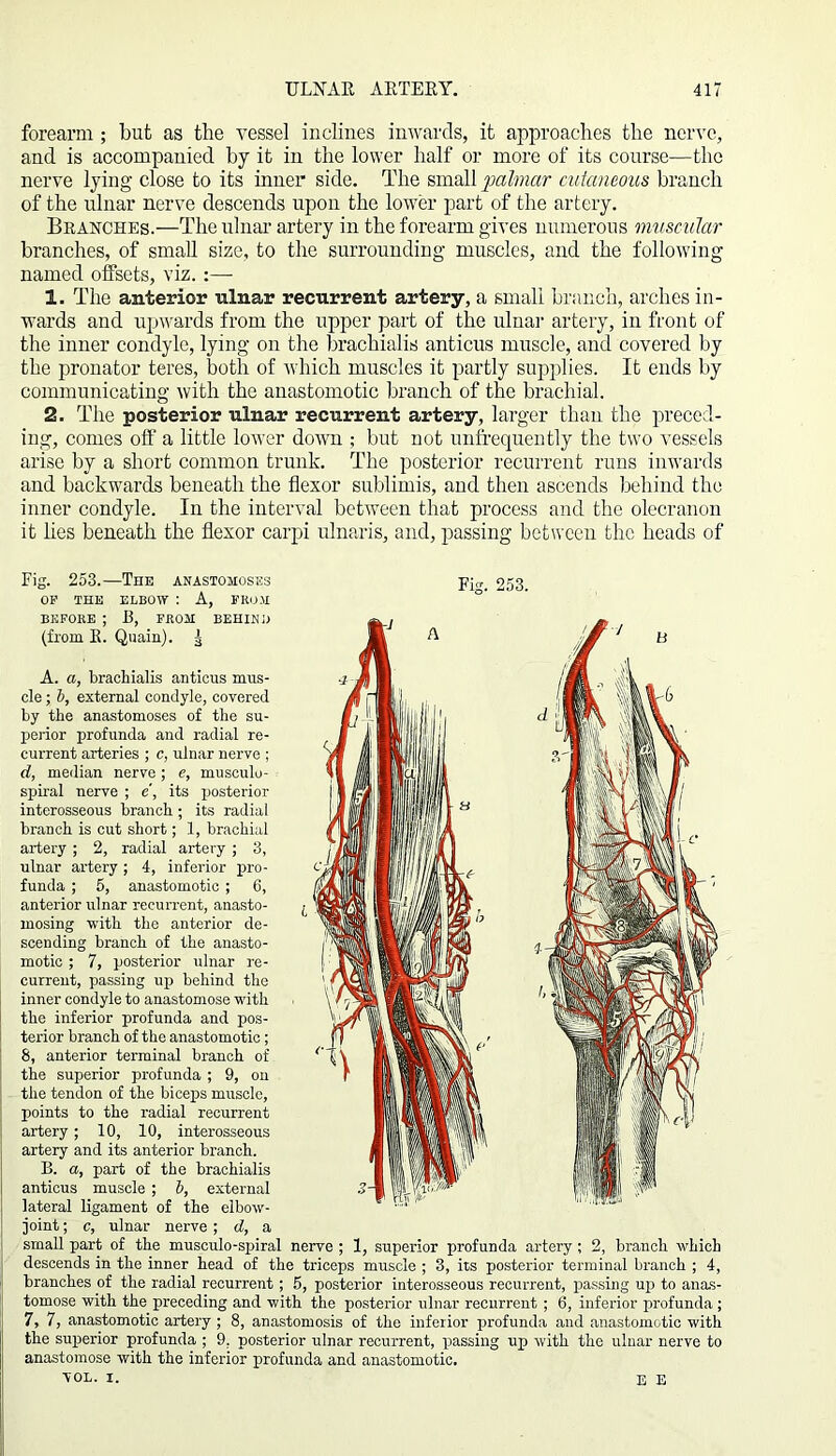 forearm ; but as the vessel inclines inwards, it approaches the nerve, and is accompanied by it in the lower half or more of its course—the nerve lying close to its inner side. The small palmar cutaneous branch of the ulnar nerve descends upon the lower part of the artery. Branches.—The ulnar artery in the forearm gives numerous muscular branches, of small size, to the surrounding muscles, and the following named offsets, viz.:—- 1. The anterior ulnar recurrent artery, a small branch, arches in- wards and upwards from the upper part of the ulnar artery, in front of the inner condyle, lying on the brachialis anticus muscle, and covered by the pronator teres, both of which muscles it partly supplies. It ends by communicating with the anastomotic branch of the brachial. 2. The posterior ulnar recurrent artery, larger than the preced- ing, comes off a little lower down ; but not unfrequeutly the two vessels arise by a short common trunk. The posterior recurrent runs inwards and backwards beneath the flexor sublimis, and then ascends behind the inner condyle. In the interval between that process and the olecranon it lies beneath the flexor carpi ulnaris, and, passing between the heads of Fig. 253.—The anastomoses OP THE ELBOW : A, FROM BEFORE ; B, FROM BEHIND (from R. Quain). ^ Fig. 253. A. a, brachialis anticus mus- cle ; b, external condyle, covered by the anastomoses of the su- perior profunda and radial re- current arteries ; c, ulnar nerve ; d, median nerve; e, musculo- spiral nerve ; e, its posterior interosseous branch ; its radial branch is cut short; 1, brachial artery ; 2, radial artery ; 3, ulnar artery ; 4, inferior pro- funda ; 5, anastomotic ; 6, anterior ulnar recurrent, anasto- mosing with the anterior de- scending branch of the anasto- motic ; 7, posterior ulnar re- current, passing up behind the inner condyle to anastomose with the inferior profunda and pos- terior branch of the anastomotic; 8, anterior terminal branch of the superior profunda ; 9, on the tendon of the biceps muscle, points to the radial recurrent artery; 10, 10, interosseous artery and its anterior branch. B. a, part of the brachialis anticus muscle; b, external lateral ligament of the elbow- joint ; c, ulnar nerve ; d, a small part of the musculo-spiral nerve ; 1, superior profunda artery; 2, branch which descends in the inner head of the triceps muscle ; 3, its posterior terminal branch ; 4, branches of the radial recurrent ; 5, posterior interosseous recurrent, passing up to anas- tomose with the preceding and with the posterior ulnar recurrent ; 6, inferior profunda ; 7, 7, anastomotic artery ; 8, anastomosis of the inferior profunda and anastomotic with the superior profunda ; 9, posterior ulnar recurrent, passing up with the ulnar nerve to anastomose with the inferior profunda and anastomotic. VOL. i. E E