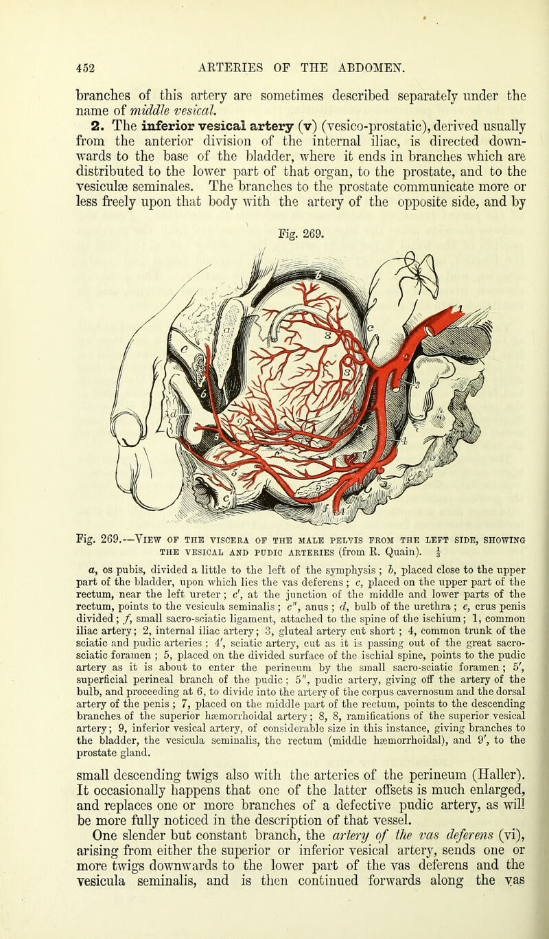 branches of this artery are sometimes described separately under the name of middle vesical. 2. The inferior vesical artery (v) (vesico-prostatic), derived usually from the anterior division of the internal iliac, is directed down- wards to the base of the bladder, where it ends in branches which are distributed to the lower part of that organ, to the prostate, and to the vesiculae seminales. The branches to the prostate communicate more or less freely upon that body with the artery of the opposite side, and by Fig. 269. Fig. 269.—View op the viscera op the male pelvis prom the left side, showing THE VESICAL AND PUDIC ARTERIES (from R. Quaill). y a, os pubis, divided a little to the left of the symphysis ; b, placed close to the upper part of the bladder, upon which lies the vas deferens ; c, placed on the upper part of the rectum, near the left ureter; c', at the junction of the middle and lower parts of the rectum, points to the vesicula seminalis ; c, anus ; d, bulb of the urethra ; e, crus penis divided; /, small sacro-sciatic ligament, attached to the spine of the ischium; 1, common iliac artery; 2, internal iliac artery; S, gluteal artery cut short ; 4, common trunk of the sciatic and pudic arteries ; 4', sciatic artery, cut as it is passing out of the great sacro- sciatic foramen ; 5, placed on the divided surface of the ischial spine, points to the pudic artery as it is about to enter the perineum by the small sacro-sciatic foramen ; 5', superficial perineal branch of the pudic; 5, pudic artery, giving off the artery of the bulb, and proceeding at 6, to divide into the artery of the corpus cavernosum and the dorsal artery of the penis ; 7, placed on the middle part of the rectum, points to the descending branches of the superior hsemorrhoidal artery; 8, 8, ramifications of the superior vesical artery; 9, inferior vesical artery, of considerable size in this instance, giving branches to the bladder, the vesicula seminalis, the rectum (middle kremorrhoidal), and 9', to the prostate gland. small descending twigs also with the arteries of the perineum (Haller). It occasionally happens that one of the latter offsets is much enlarged, and replaces one or more branches of a defective pudic artery, as will be more fully noticed in the description of that vessel. One slender but constant branch, the artery of the vas deferens (vi), arising from either the superior or inferior vesical artery, sends one or more twigs downwards to the lower part of the vas deferens and the vesicula seminalis, and is then continued forwards along the vas