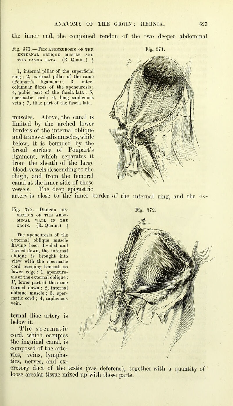 the inner end, the conjoined tendon of the two deeper abdominal Fig. 371.—The aponeurosis of the EXTERNAL OBLIQUE MUSCLE AND THE FASCIA LATA. (It. Quain.) i 1, internal pillar of the superficial ring; 2, external pillar of the same (Poupart’s ligament); 3, inter- columnar fibres of the aponeurosis ; 4, pubic part of the fascia lata ; 5, spermatic cord; 6, long saphenous vein ; 7, iliac part of the fascia lata. muscles. Above, the canal is limited by the arched lower borders of the internal oblique and transversalis muscles, while below, it is bounded by the broad surface of Poupart’s ligament, which separates it from the sheath of the large blood-vessels descending to the thigh, and from the femoral canal at the inner side of those vessels. The deep epigastric artery is close to the inner b Fig. 371. r of the internal ring, and the ex- Fig. 372.—Deeper dis- Fig. 372. SECTION OF THE ABDO- MINAL WALL IN THE groin. (E. Quain.) ± The aponeurosis of the external oblique muscle having been divided and turned down, the internal oblique is brought into view with the spermatic cord escaping beneath its lower edge: 1, aponeuro- sis of the external oblique : 1', lower part of the same turned down ; 2, internal oblique muscle ; 3, sper- matic cord ; 4, saphenous vein. ternal iliac artery is below it. The spermatic cord, which occupies the inguinal canal, is composed of the arte- ries, veins, lympha- tics, nerves, and ex- cretory duct of the testis (vas deferens), together with a quantity of loose areolar tissue mixed up with those parts.