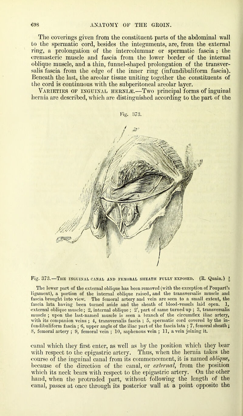 The coverings given from the constituent parts of the abdominal wall to the spermatic cord, besides the integuments, are, from the external ring, a prolongation of the intercolumnar or spermatic fascia ; the cremasteric muscle and fascia from the lower border of the internal oblique muscle, and a thin, funnel-shaped prolongation of the transver- salis fascia from the edge of the inner ring (infundibuliform fascia). Beneath the last, the areolar tissue uniting together the constituents of the cord is continuous with the subperitoneal areolar layer. Varieties of inguinal hernia.—Two principal forms of inguinal hernia are described, which are distinguished according to the part of the Fig. 373.—The inguinal canal and femoral sheath fully exposed. (R. Quain.) § The lower part of the external oblique has been removed (with the exception of Poupart’s ligament), a portion of the internal oblique raised, and the transversalis muscle and fascia brought into view. The femoral artery and vein are seen to a small extent, the fascia lata having been turned aside and the sheath of blood-vessels laid open. 1, external oblique muscle; 2, internal oblique ; 2', part of same turned up ; 3, transversalis muscle ; upon the last-named muscle is seen a branch of the circumflex iliac artery, with its companion veins ; 4, transversalis fascia ; 5, spermatic cord covered by the in- fundibuliform fascia ; 6, upper angle of the iliac part of the fascia lata ; 7, femoral sheath; 8, femoral artery ; 9, femoral vein ; 10, saphenous vein ; 11, a vein joining it. canal which they first enter, as well as by the position which they bear with respect to the epigastric artery. Thus, when the hernia takes the course of the inguinal canal from its commencement, it is named oblique, because of the direction of the canal, or external, from the position which its neck bears with respect to the epigastric artery. On the other hand, when the protruded part, without following the length of the canal, passes at once through its posterior wall at a point opposite the