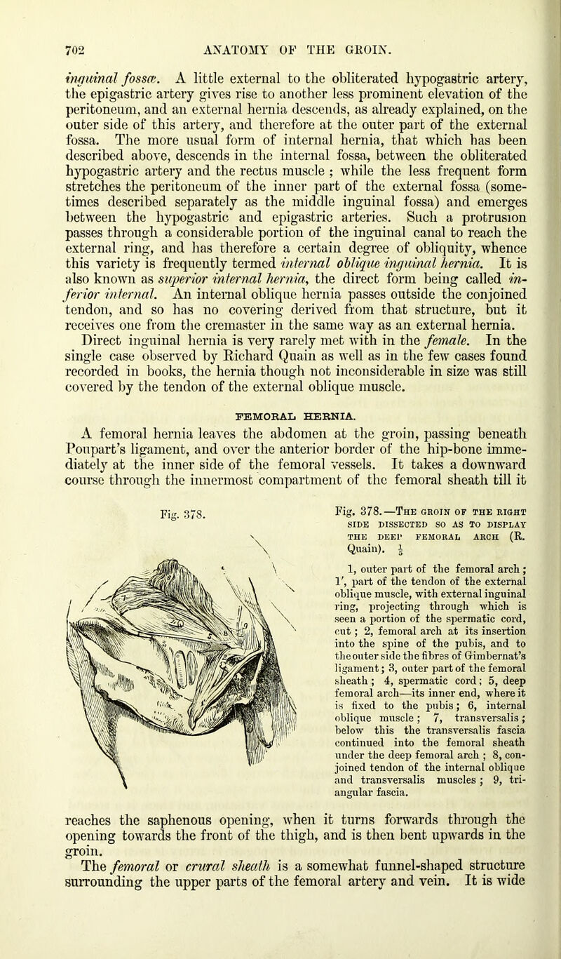 inguinal fossa;. A little external to the obliterated hypogastric artery, the epigastric artery gives rise to another less prominent elevation of the peritoneum, and an external hernia descends, as already explained, on the outer side of this artery, and therefore at the outer part of the external fossa. The more usual form of internal hernia, that which has been described above, descends in the internal fossa, between the obliterated hypogastric artery and the rectus muscle ; while the less frequent form stretches the peritoneum of the inner part of the external fossa (some- times described separately as the middle inguinal fossa) and emerges between the hypogastric and epigastric arteries. Such a protrusion passes through a considerable portion of the inguinal canal to reach the external ring, and has therefore a certain degree of obliquity, whence this variety is frequently termed internal oblique inguinal hernia. It is also known as superior internal hernia, the direct form being called in- ferior internal. An internal oblique hernia passes outside the conjoined tendon, and so has no covering derived from that structure, but it receives one from the cremaster in the same way as an external hernia. Direct inguinal hernia is very rarely met with in the female. In the single case observed by Richard Quain as well as in the few cases found recorded in books, the hernia though not inconsiderable in size was still covered by the tendon of the external oblique muscle. FEMORAL HERNIA. A femoral hernia leaves the abdomen at the groin, passing beneath Poupart’s ligament, and over the anterior border of the hip-bone imme- diately at the inner side of the femoral vessels. It takes a downward course through the innermost compartment of the femoral sheath till it Fig. 378.—The groin of the right SIDE DISSECTED SO AS TO DISPLAY THE DEEP FEMORAL ARCH (R. Quain). I 1, outer part of tlie femoral arch; 1', part of the tendon of the external oblique muscle, with external inguinal ring, projecting through which is seen a portion of the spermatic cord, cut; 2, femoral arch at its insertion into the spine of the pubis, and to the outer side the fibres of Gimbernat’s ligament; 3, outer part of the femoral sheath ; 4, spermatic cord; 5, deep femoral arch—its inner end, where it is fixed to the pubis; 6, internal oblique muscle; 7, transversalis; below this the transversalis fascia continued into the femoral sheath under the deep femoral arch ; 8, con- joined tendon of the internal oblique and transversalis muscles; 9, tri- angular fascia. reaches the saphenous opening, when it turns forwards through the opening towards the front of the thigh, and is then bent upwards in the groin. The femoral or crural sheath is a somewhat funnel-shaped structure surrounding the upper parts of the femoral artery and vein. It is wide Fig. 378.