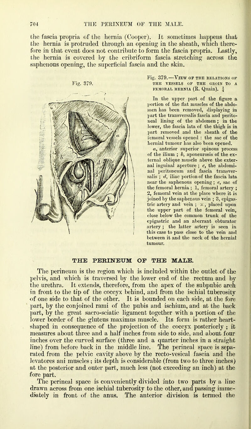 the fascia propria of the hernia (Cooper), ft sometimes happens that the hernia is protruded through an openiug in the sheath, which there- fore in that event does not contribute to form the fascia propria. Lastly, the hernia is covered by the cribriform fascia stretching across the saphenous opening, the superficial fascia and the skin. Fig. 379. r Fig. 379.—View op tiie relations op THE VESSELS OP THE GROIN TO A FEMORAL HERNIA (R. Qliain). \ In the upper part of the figure a portion of the flat muscles of the abdo- men has been removed, displaying in part the transversalis fascia and perito- neal lining of the abdomen; in the lower, the fascia lata of the thigh is in part removed and the sheath of the femoral vessels opened : the sac of the hernial tumour has also been opened. a, anterior superior spinous process of the ilium ; b, aponeurosis of the ex- ternal oblique muscle above the exter- nal inguinal aperture ; c, the abdomi- nal peritoneum and fascia transver- salis ; </, iliac portion of the fascia lata, near the saphenous opening; e, sac of the femoral hernia ; 1, femoral artery ; 2, femoral vein at the place where it is joined by the saphenous vein ; 3, epigas- i trie artery and vein ; x , placed upon the upper part of the femoral vein, close below the common trunk of the epigastric and an aberrant obturator artery ; the latter artery is seen in I this case to pass close to the vein and between it and the neck of the hernial tumour. THE PERINEUM OF THE MALE. The perineum is the region which is included within the outlet of the pelvis, and which is traversed by the lower end of the rectum and by the urethra. It extends, therefore, from the apex of the subpubic arch in front to the tip of the coccyx behind, and from the ischial tuberosity of one side to that of the other. It is bounded on each side, at the fore part, by the conjoined rami of the pubis and ischium, and at the back part, by the great sacro-sciatic ligament together with a portion of the lower border of the gluteus maximus muscle. Its form is rather heart- shaped in consequence of the projection of the coccyx posteriorly ; it measures about three and a half inches from side to side, and about four inches over the curved surface (three and a quarter inches in a straight line) from before back in the middle line. The perineal space is sepa- rated from the pelvic cavity above by the recto-vesical fascia and the levatores ani muscles; its depth is considerable (from two to three inches) at the posterior and outer part, much less (not exceeding an inch) at the fore part. The perineal space is conveniently divided into two parts by a line drawn across from one ischial tuberosity to the other, and passing imme- diately in front of the anus. The anterior division is termed the