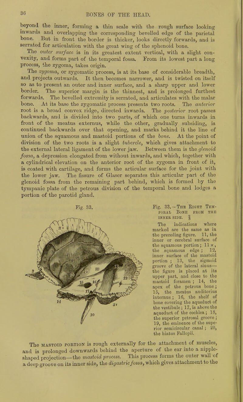 beyond the inner, forming a thin scale with tho rough surface looking inwards and overlapping the corresponding bevelled edge of the parietal bone. Bnt in front the border is thicker, looks directly forwards, and is serrated for articulation with the great wing of the sphenoid bone. The outer surface is in its greatest extent vertical, with a slight con- vexity, and forms part of the temporal fossa. From its lowest part a long process, the zygoma, takes origin. The zygoma, or zygomatic process, is at its base of considerable breadth, and projects outwards. It then becomes narrower, and is twisted on itself so as to present an outer and inner surface, and a sharp upper and lower border. The superior margin is the thinnest, and is prolonged furthest forwards. The bevelled extremity is serrated, and articulates with the malar bone. At its base the zygomatic process presents two roots. The anterior root is a broad convex ridge, directed inwards. The posterior root passes backwards, and is divided into two parts, of which one turns inwards in front of the meatus externus, while the other, gradually subsiding, is continued backwards over that opening, and marks behind it the line of union of the squamous and mastoid portions of the bone. At the point of division of the two roots is a slight tubercle, which gives attachment to the external lateral ligament of the lower jaw. Between them is the glenoid fossa, a depression elongated from without inwards, and which, together with a cylindrical elevation on the anterior root of the zygoma in front of it, is coated with cartilage, and forms the articular surface for the joint with the lower jaw. The fissure of Glaser separates this articular part of the glenoid fossa from the remaining part behind, which is formed by the tympanic plate of the petrous division of the temporal bone and lodges a portion of the parotid gland. Fig. 33. —The Eight Tem- poral Bone from the innkr side. i The indications -where marked are the same as in the preceding figure. 11, the inner or cerebral surface of the squamous portion; 11 x , the squamous edge ; 12, inner surface of the mastoid portion ; 13, the sigmoid groove of the lateral sinus— the figure is placed at its upper part, and close to the mastoid foramen ; 14, the apex of the petrous bone; 15, the meatus auditorius internus; 16, the shelf of bone covering the aqueduct of the vestibule ; 17, is above the aqueduct of the cochlea ; 18, the superior petrosal groove ; 19, the eminence of the supe- rior semicircular canal ; W, the hiatus Fallopii. The MASTOID PORTION is rough externally for the attachment of muscles, and is prolonged downwards behind the aperture of the ear into a nipple- shaped projectfon—the mastoid process. This process forms the outer wall of a deep groove on its inner side, the digastric fossa, which gives attachment to the
