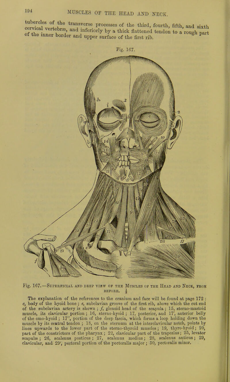 tubercles of the transverse processes of the third, fourth, fifth, and sixth cervical vertebr^, and inferiorly by a thick flattened tendo^ to a rough p^^^^^ of the inner border and upper surface of the first rib. ^ ^ Fig. 167. Fig. 167.—Superficial and deep vibw op the Muscles op the Head and Neck, from BEFORE. ^ The explanation of the references to the cranium and face will be found at page 172 : c, body of the hyoid bone ; e, subclavian groove of the first rib, above which the cut end of the subclavian artery is shown ; /, glenoid head of the scapula ; 15, sterno-mastoid muscle, its clavicular portion; 16, sterno-hyoid ; 17, posterior, and 17', anterior belly of the omo-byoid ; 17, portion of the deep fascia, which forms a loop holding down the muscle by its central tendon ; 18, on the sternum at the interclavicular notch, points by lines upwards to the lower part of the sterno-thyroid muscles; 19, thyro-hyoid; 20, part of the constrictors of the pharynx ; 22, clavicular part of the trapezius; 25, levator scapulae ; 26, scalenus posticus ; 27, scalenus medius; 28, scalenus anticus; 29, clavicular, and 29', pectoral portion of the peotoralis major ; 30, pectoralis minor.